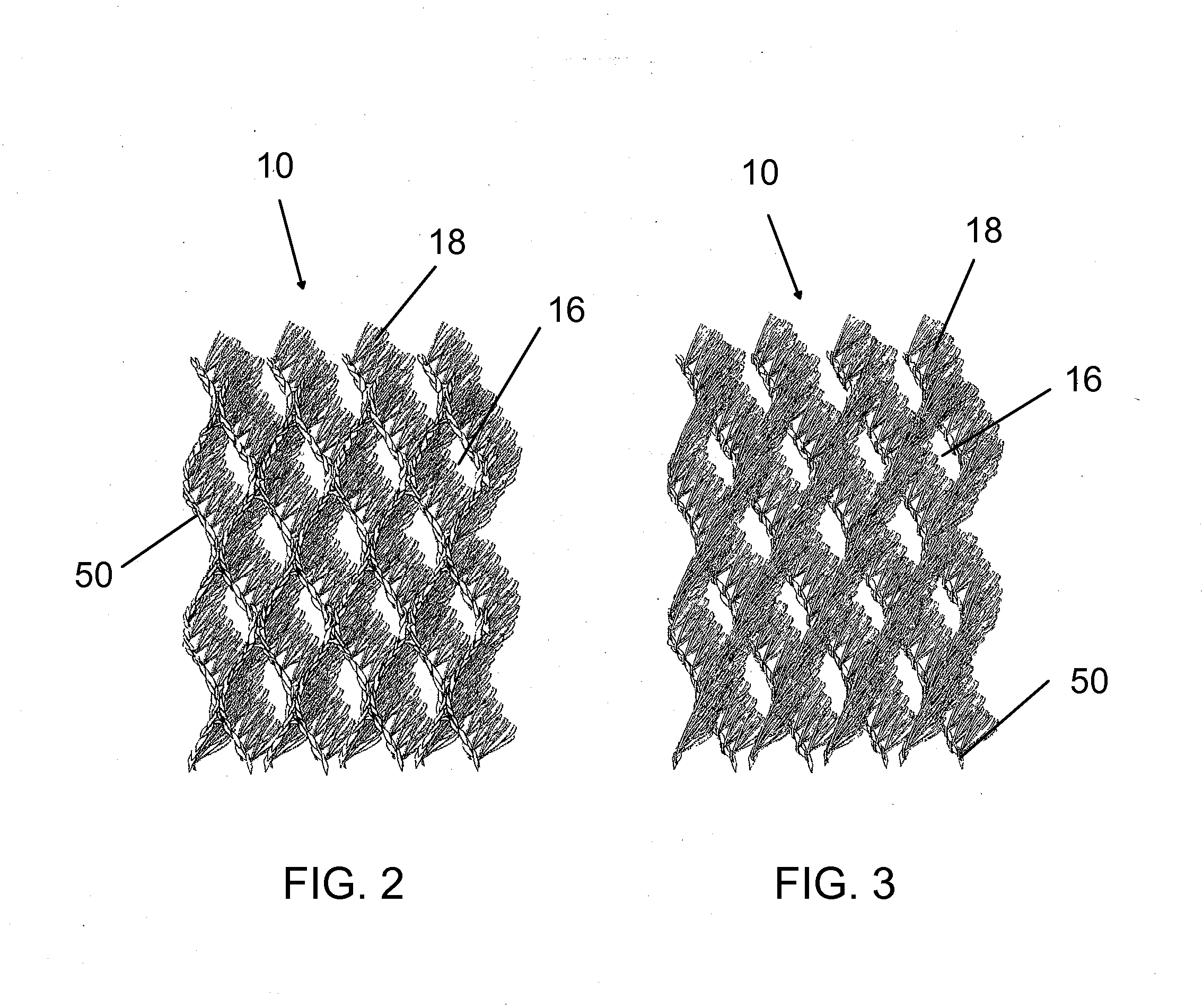 Removable support surface