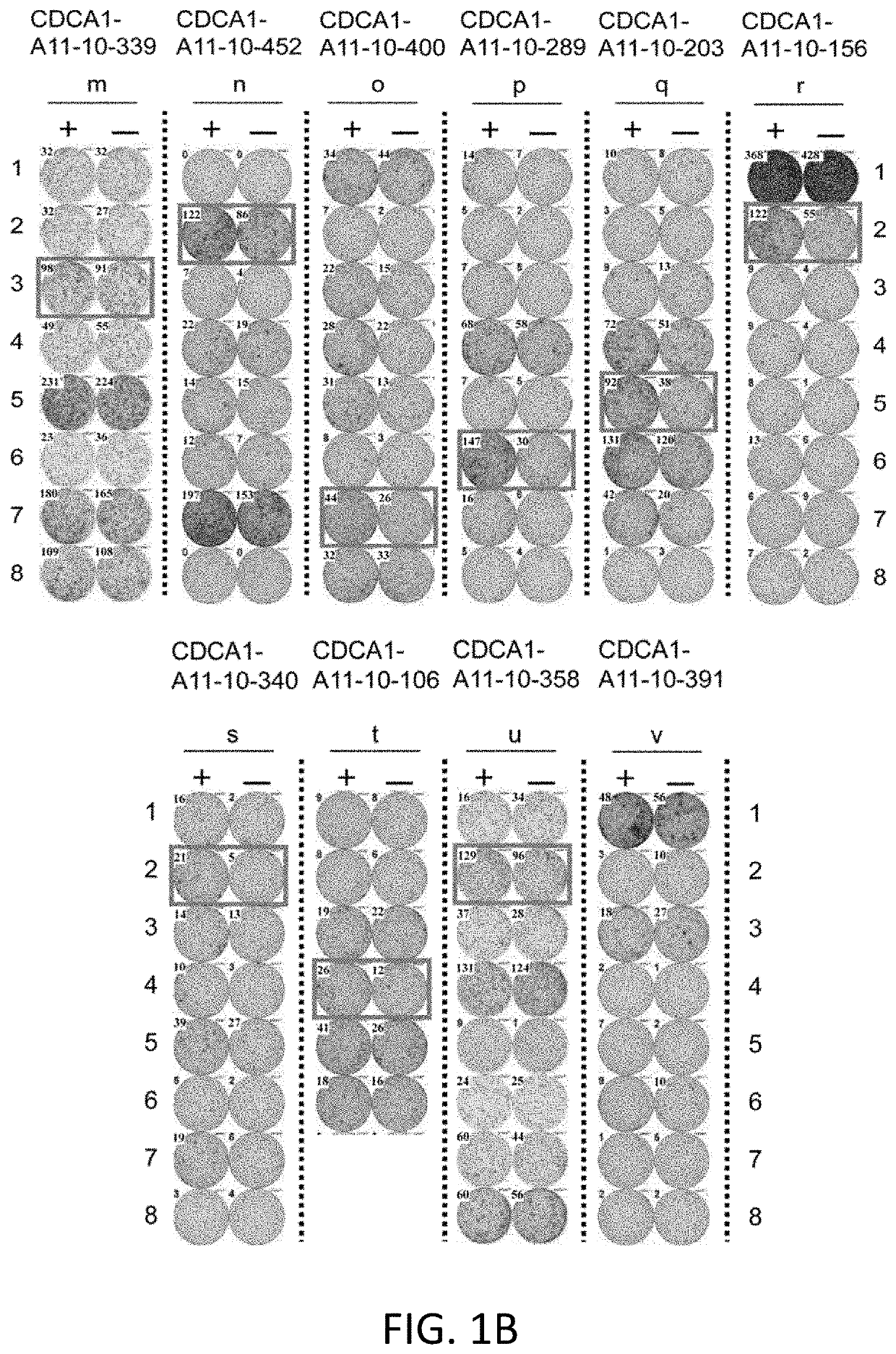 CDCA1-derived peptide and vaccine containing same