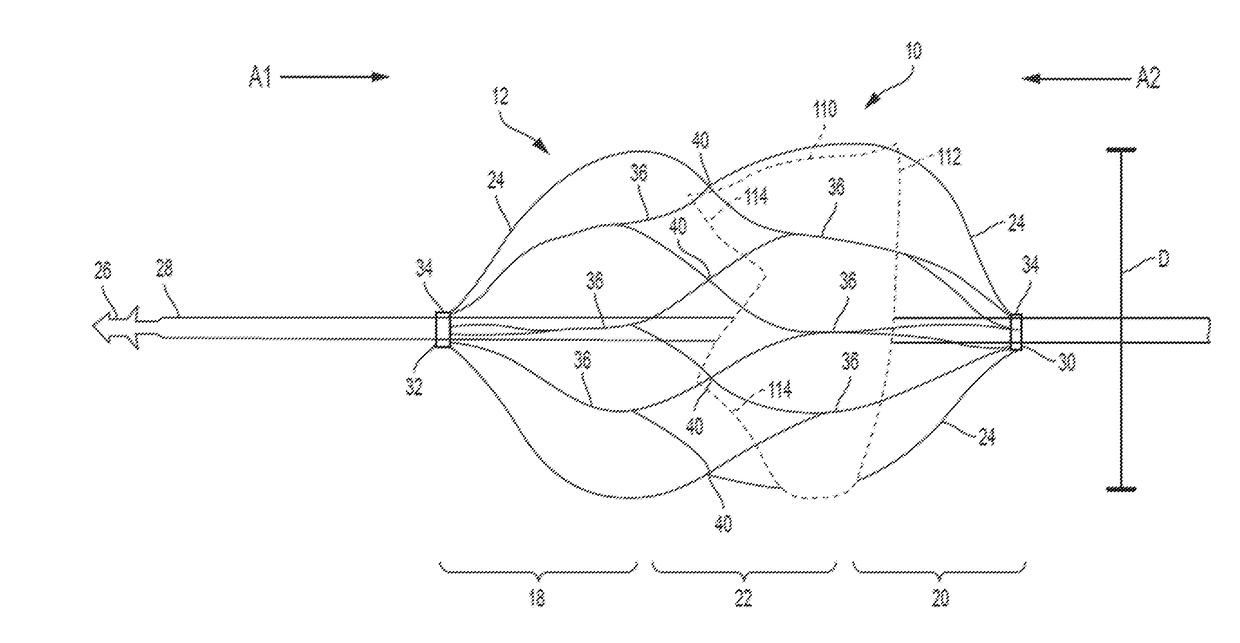 Retrievable Self-expanding Non-thrombogenic Low-profile Percutaneous Atrioventricular Valve Prosthesis