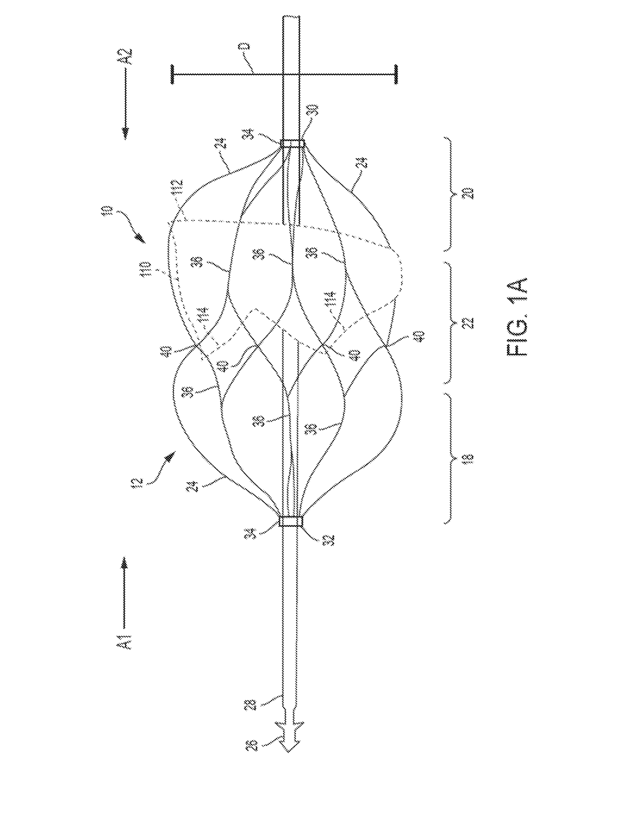 Retrievable Self-expanding Non-thrombogenic Low-profile Percutaneous Atrioventricular Valve Prosthesis