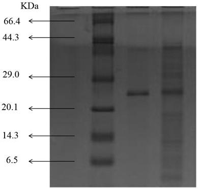 Bio-catalytic method for synthesizing optical activity 2R-fluorocarboxylic acid and 2R-hydroxy carboxylic acid