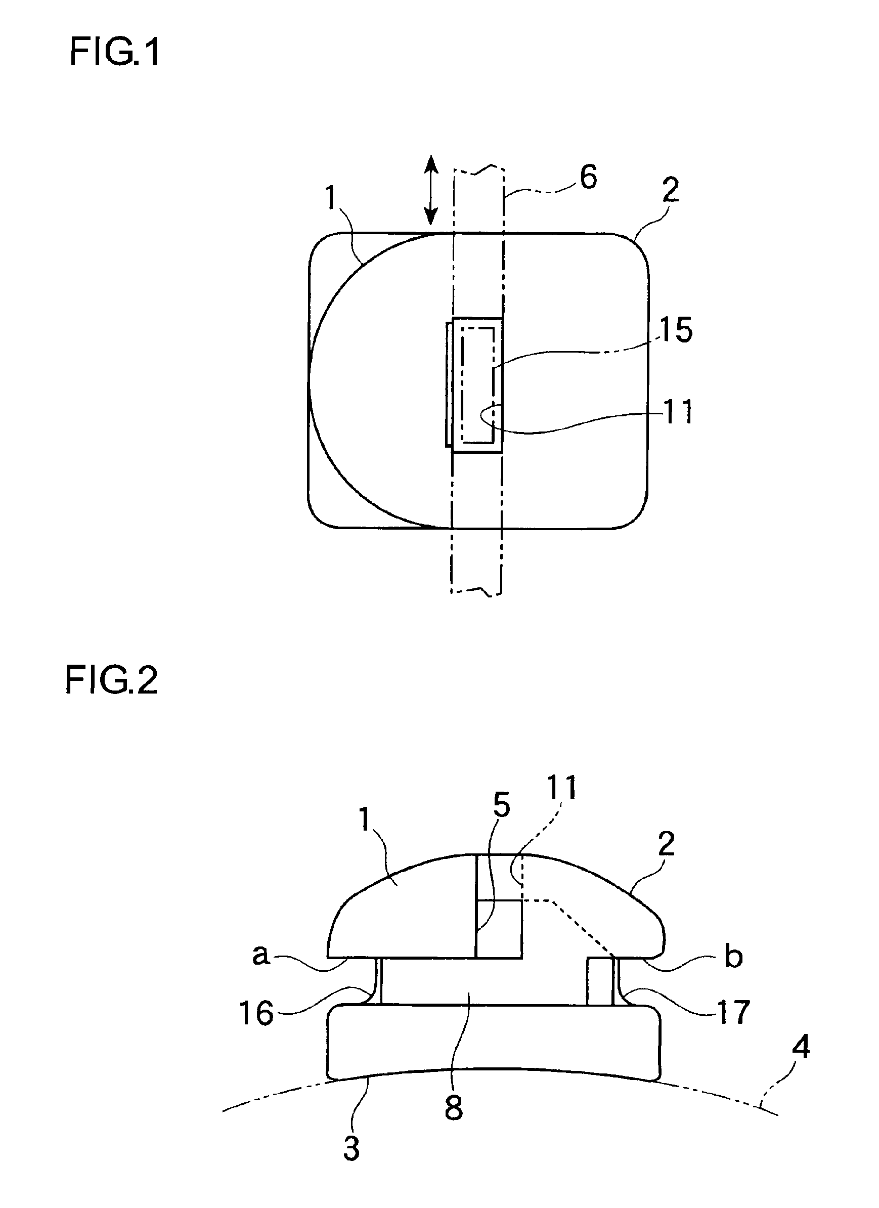 Orthodontic bracket