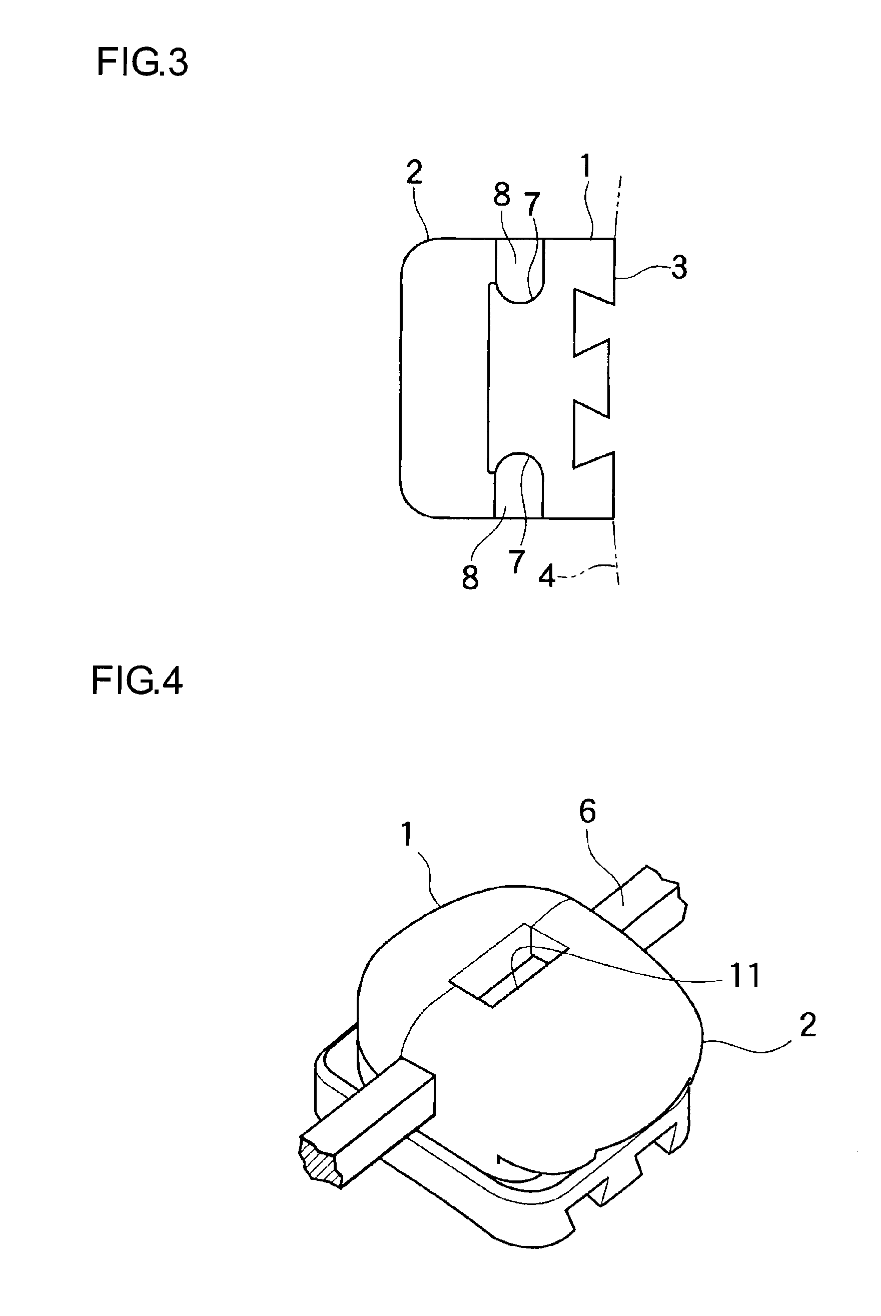 Orthodontic bracket