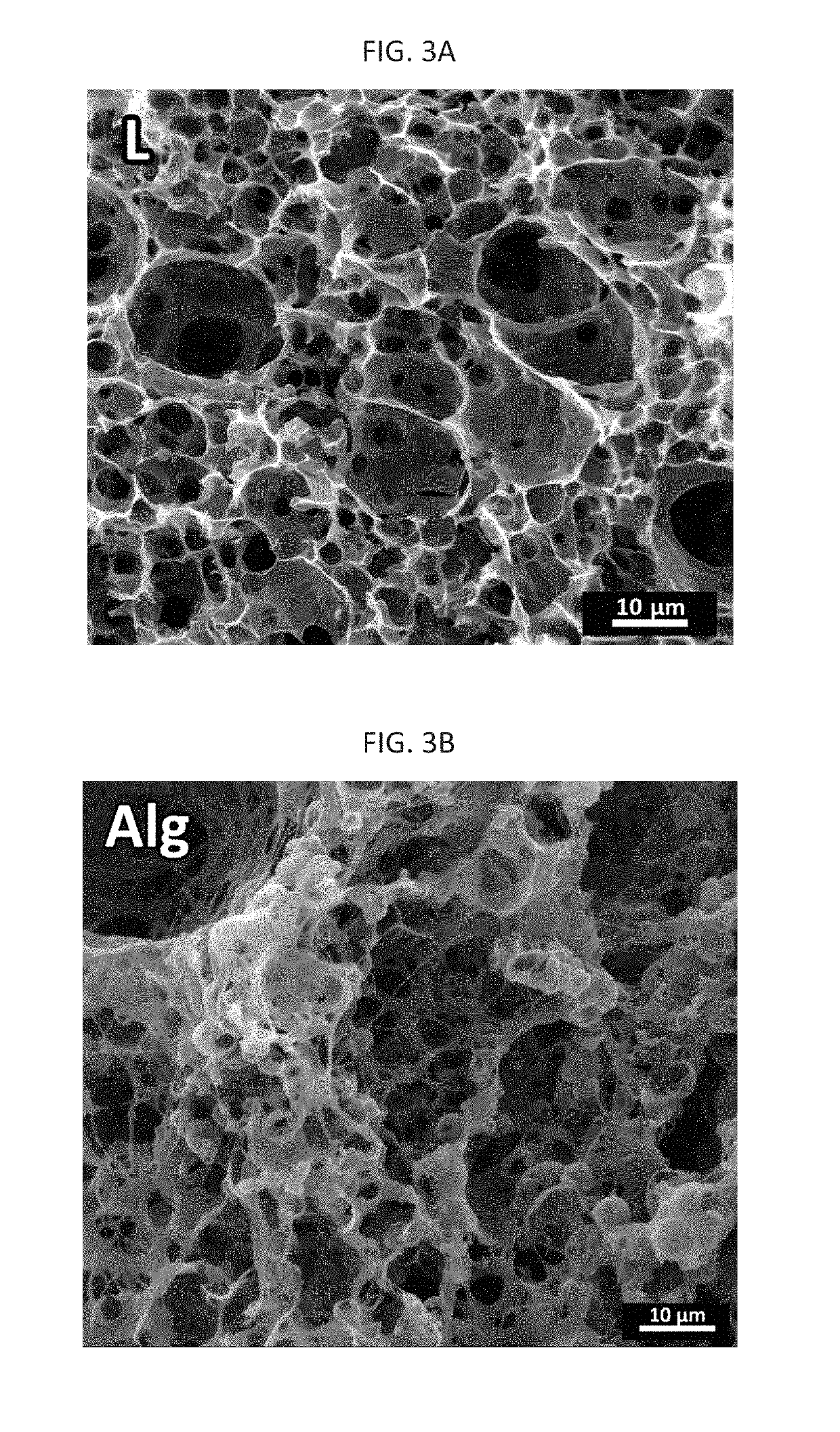 Polyhipes by interfacial step-growth polymerization