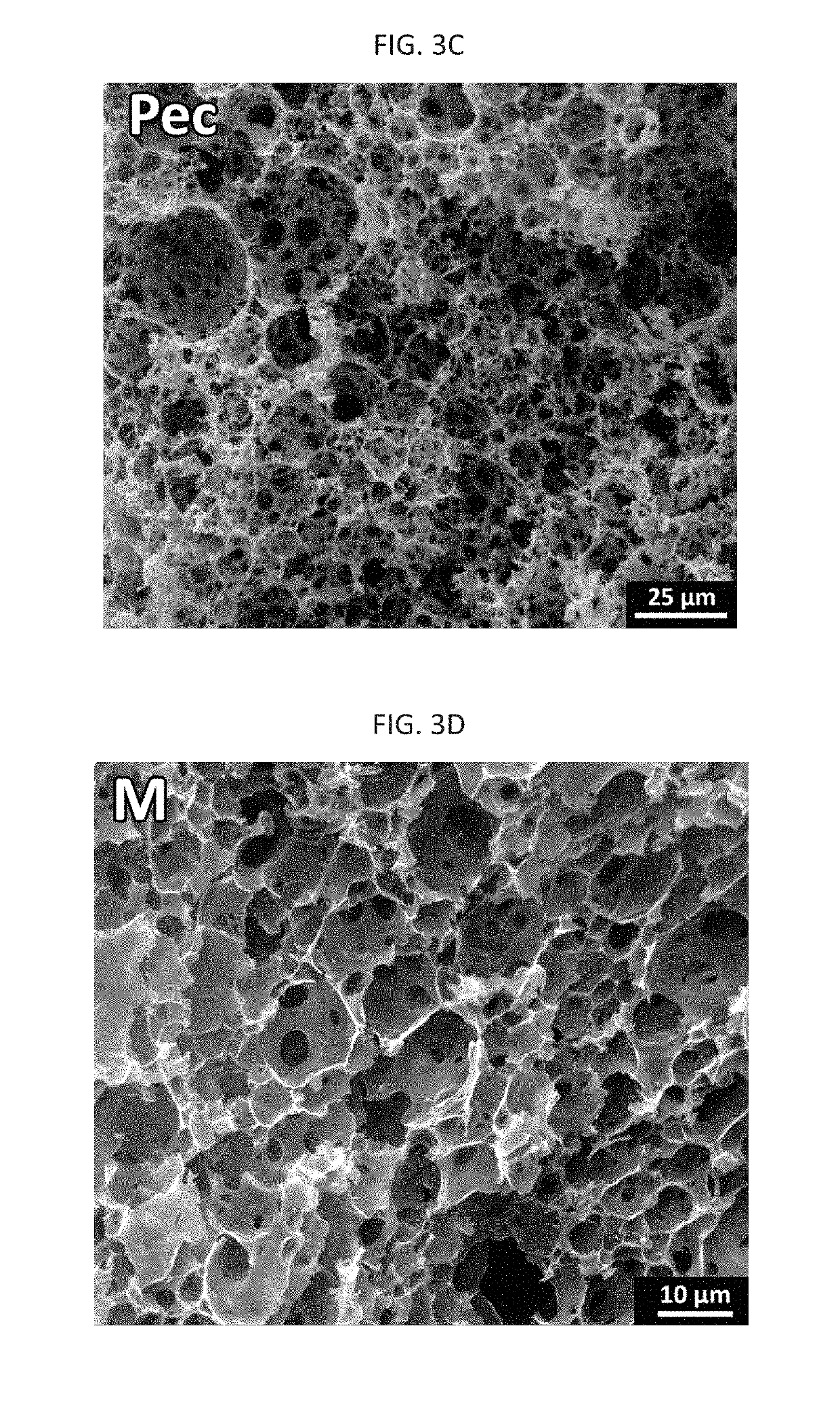 Polyhipes by interfacial step-growth polymerization