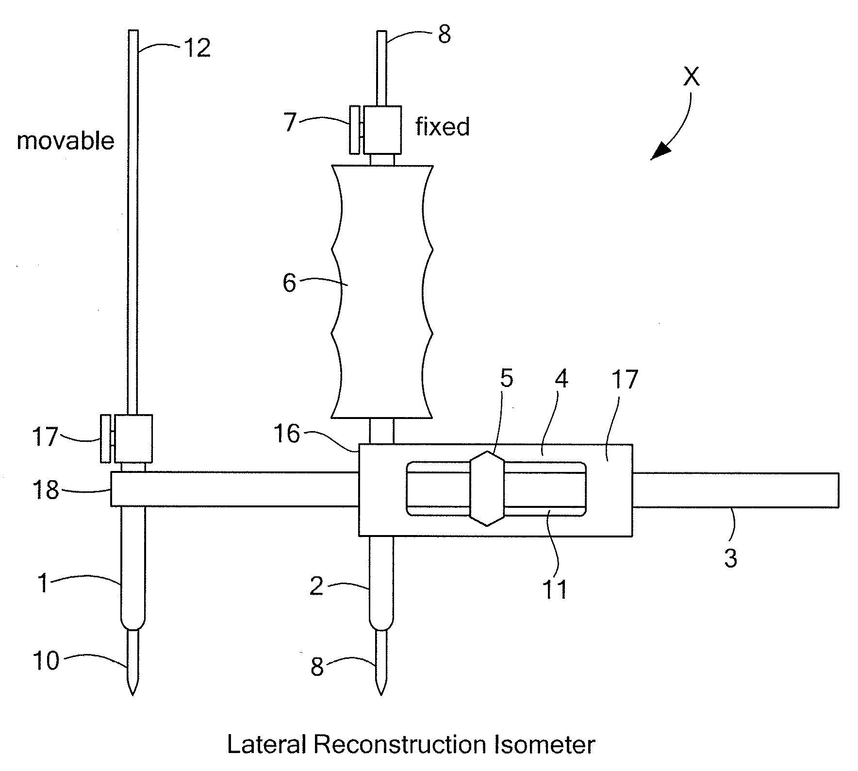 Surgical Device for Anterolateral and Posterolateral Reconstruction