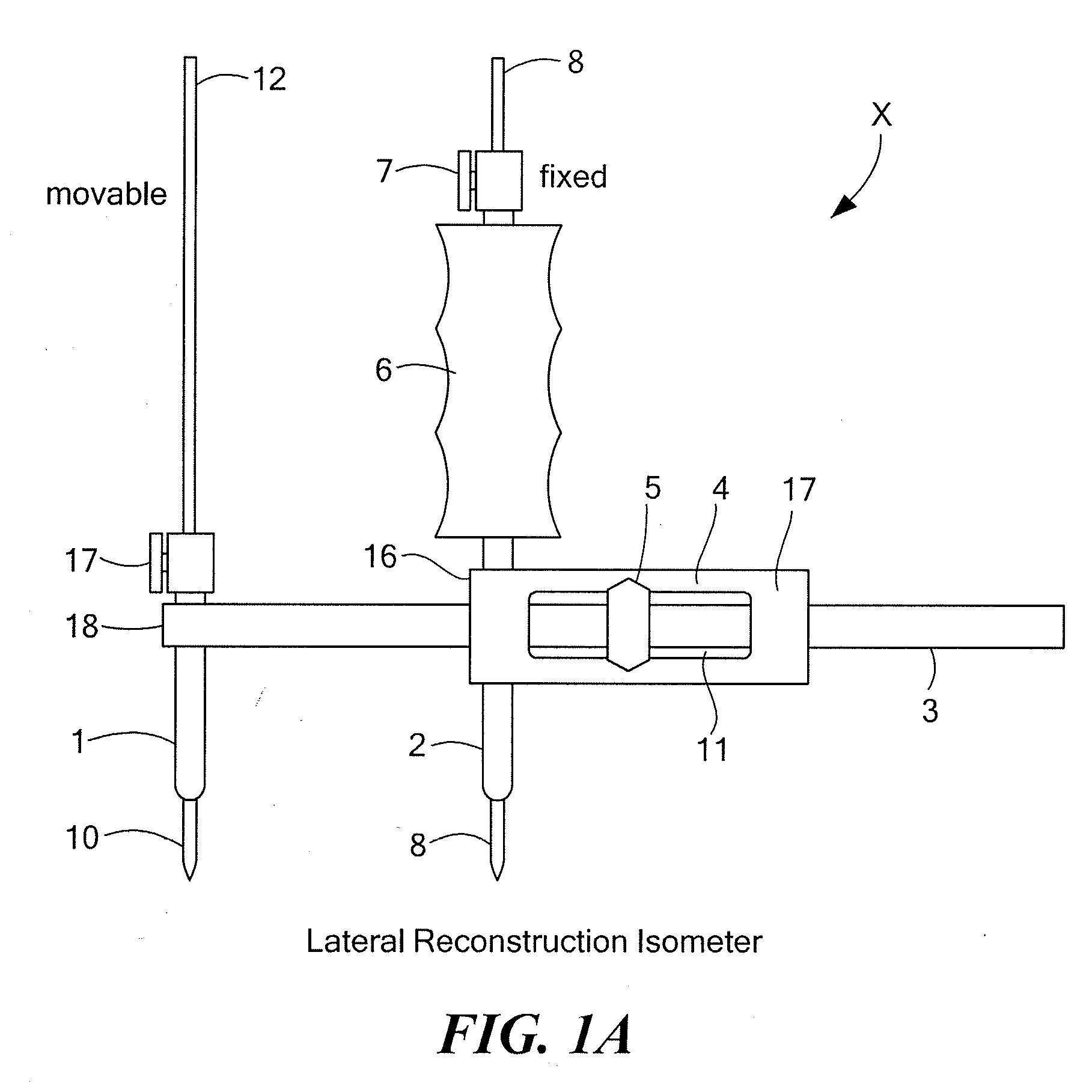 Surgical Device for Anterolateral and Posterolateral Reconstruction