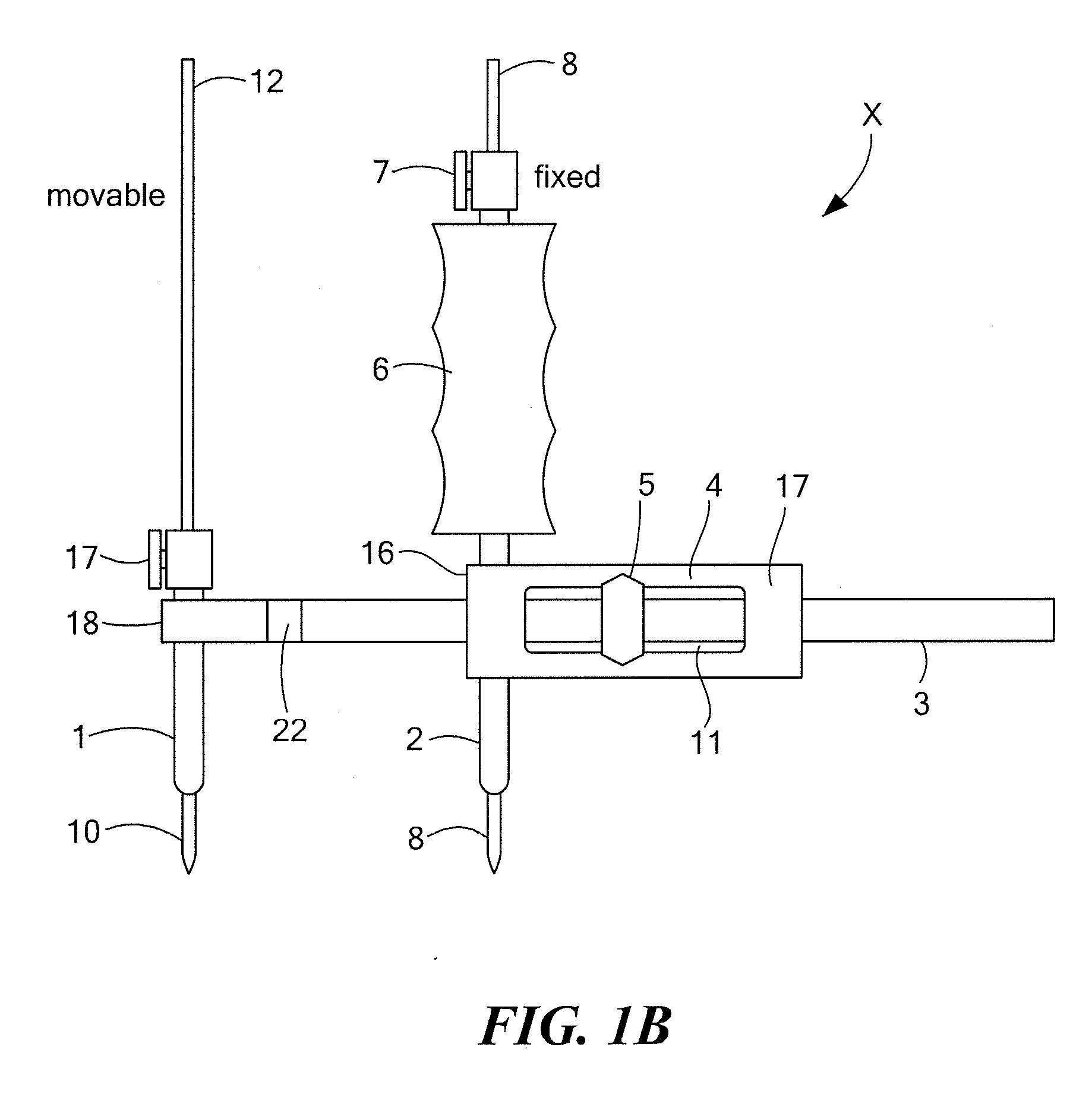 Surgical Device for Anterolateral and Posterolateral Reconstruction