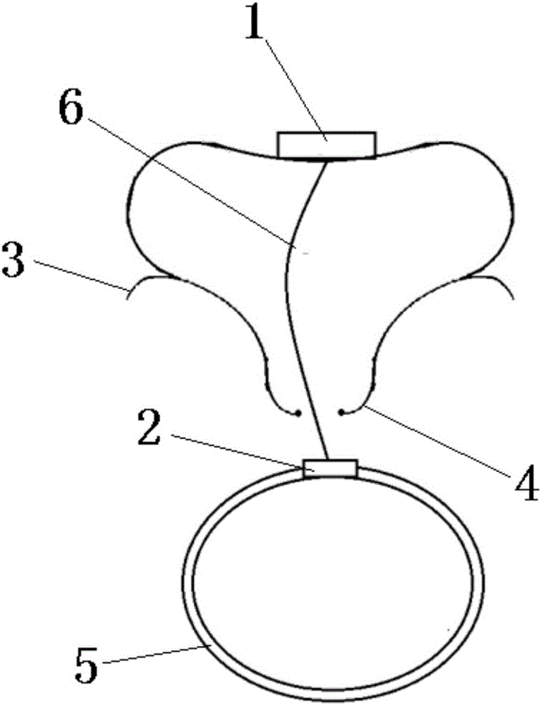 Intelligent drowning prevention self-rescue device