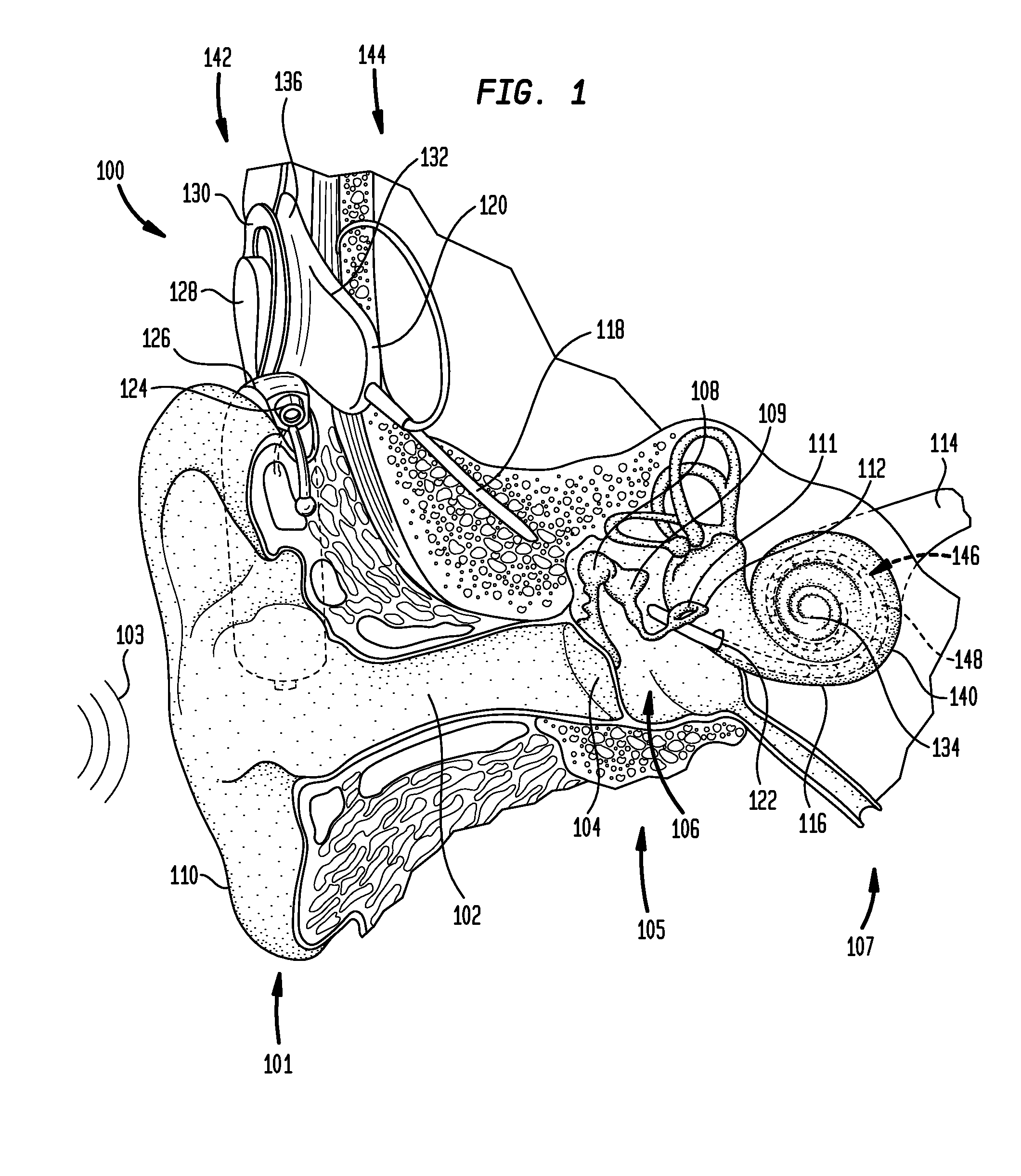 Manufacturing an electrode carrier for an implantable medical device