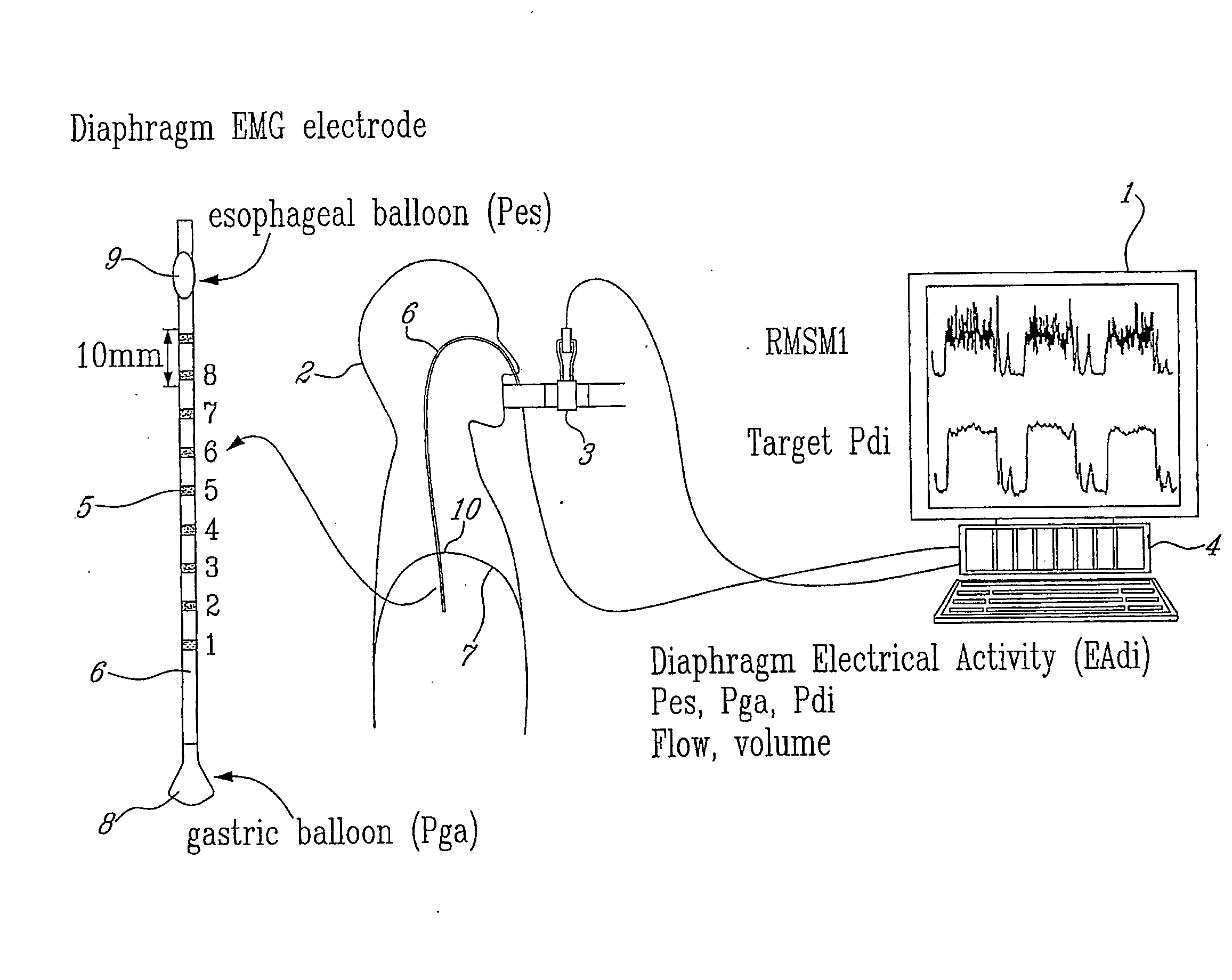 Method and Device Using Myoelectrical Activity for Optimizing a Patient's Ventilatory Assist