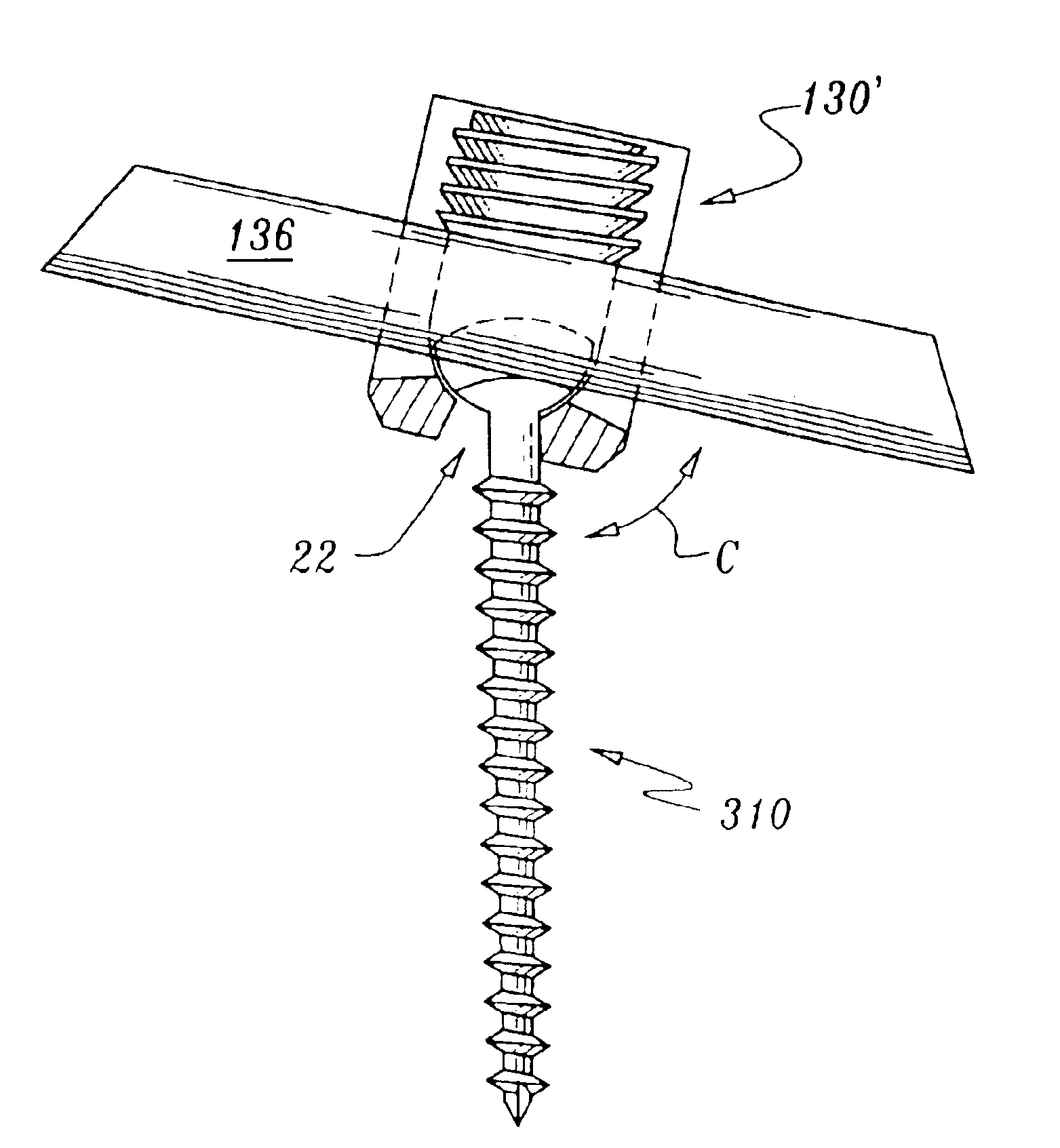 Orthopedic stabilization device and method