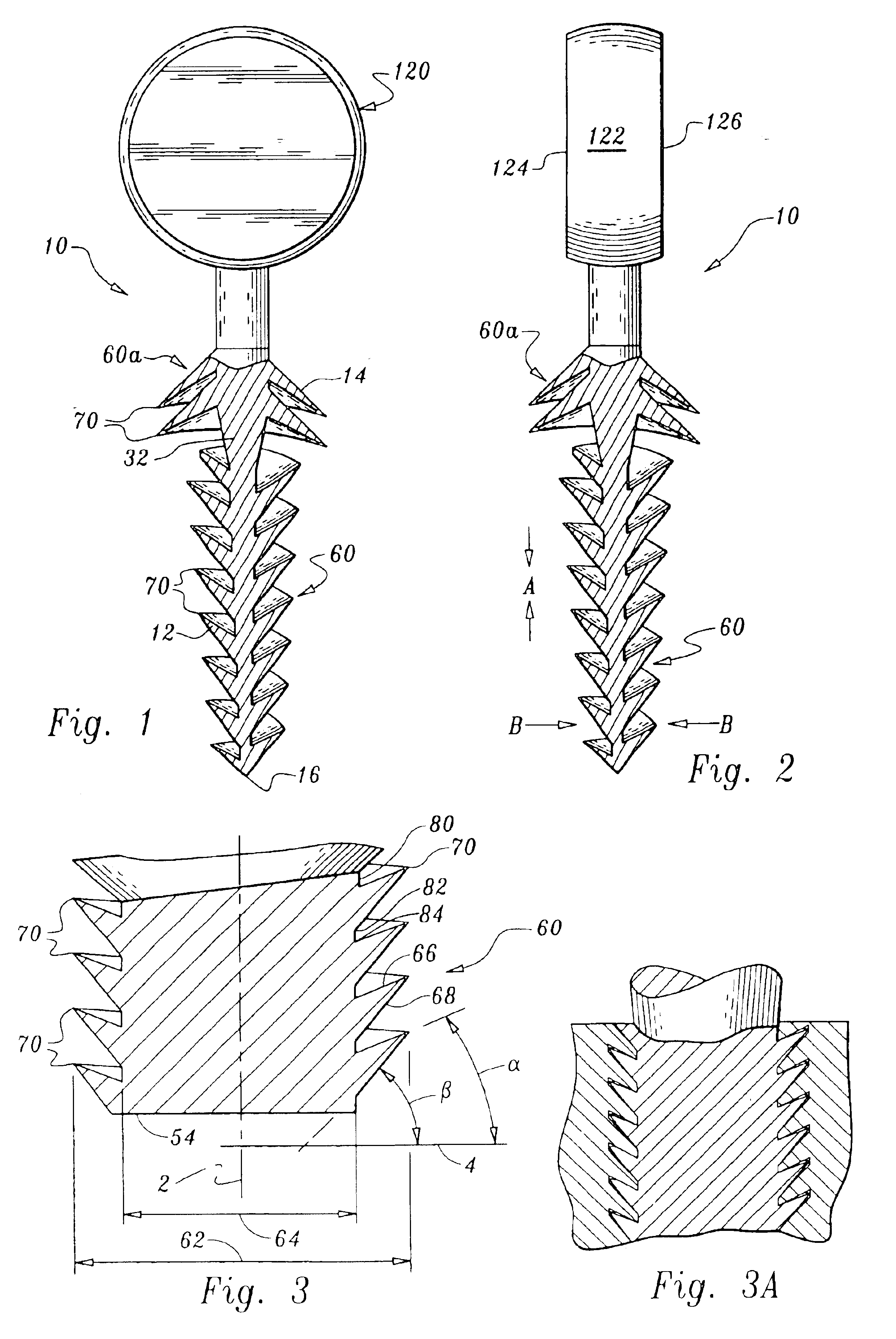 Orthopedic stabilization device and method