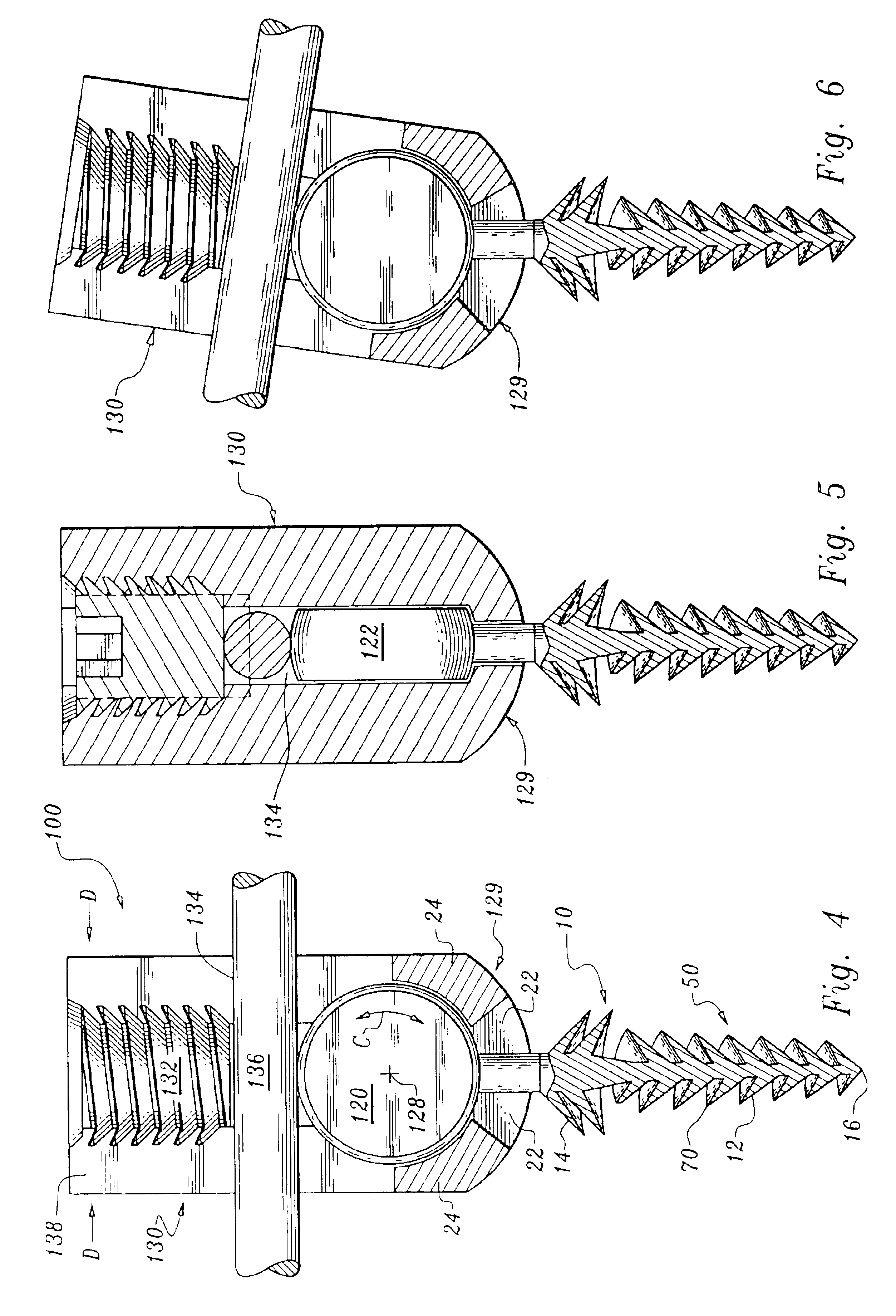 Orthopedic stabilization device and method