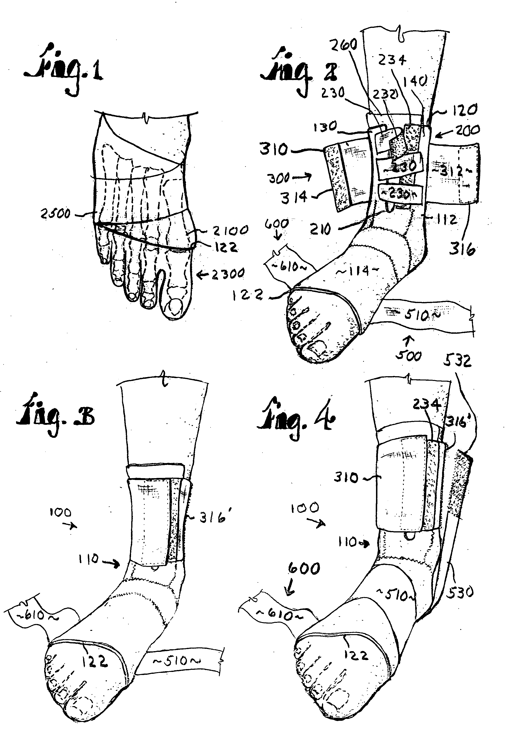 Counterforce brace