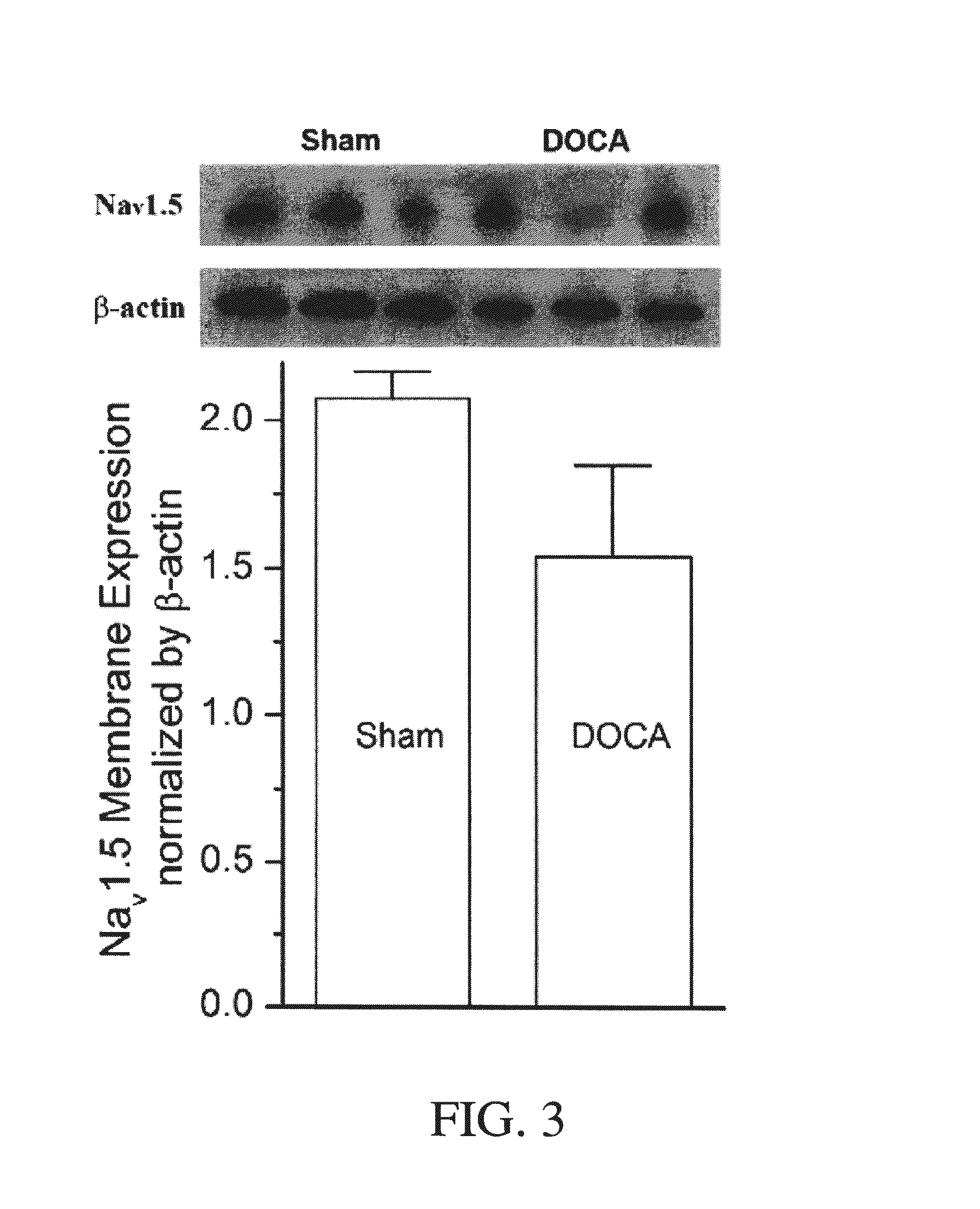 Method for ameliorating or preventing arrhythmic risk associated with cardiomyopathy by improving conduction velocity