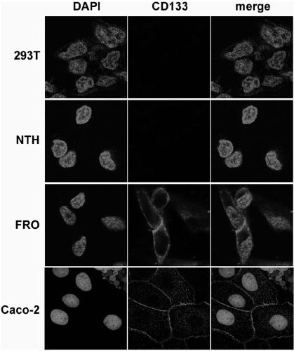 Aptamer for performing target combination on CD133 albumen as well as screening method and application thereof