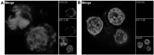 Aptamer for performing target combination on CD133 albumen as well as screening method and application thereof