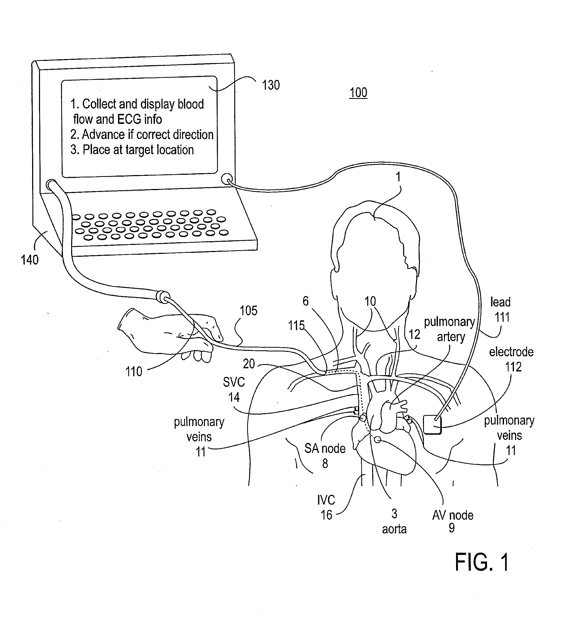 Endovascular devices and methods of use