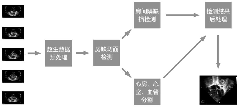 Deep learning atrial septal defect detection method and device