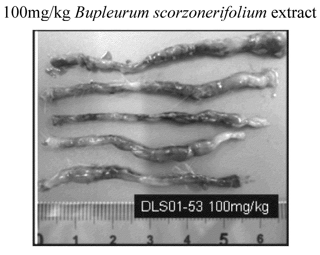 Method for treating or relieving inflammatory bowel disease