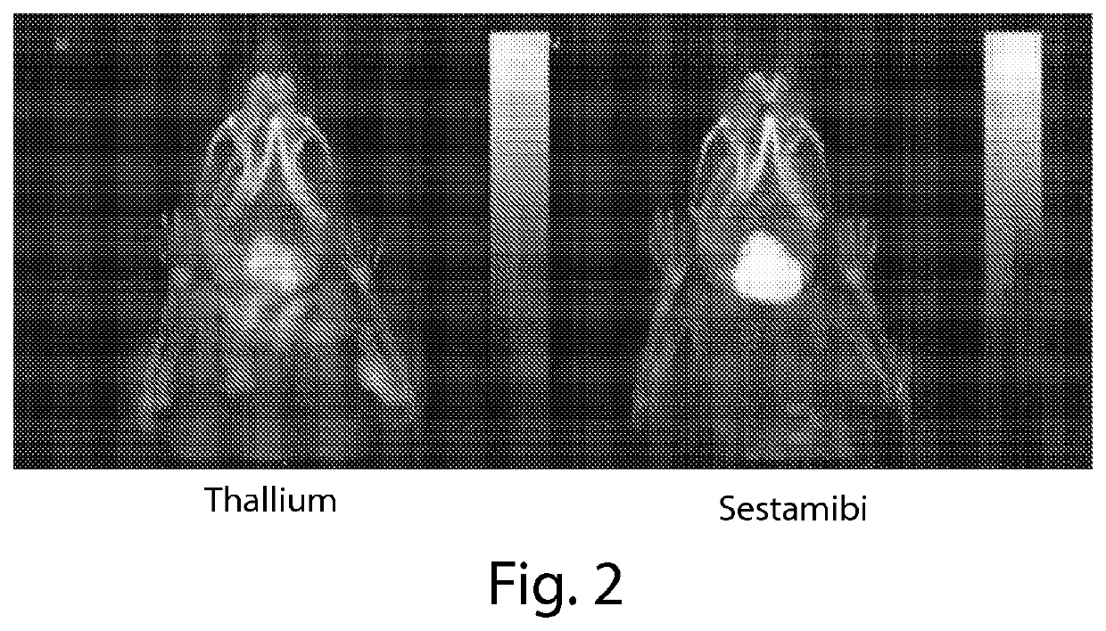 Compositions and methods for assessing neuromuscular function