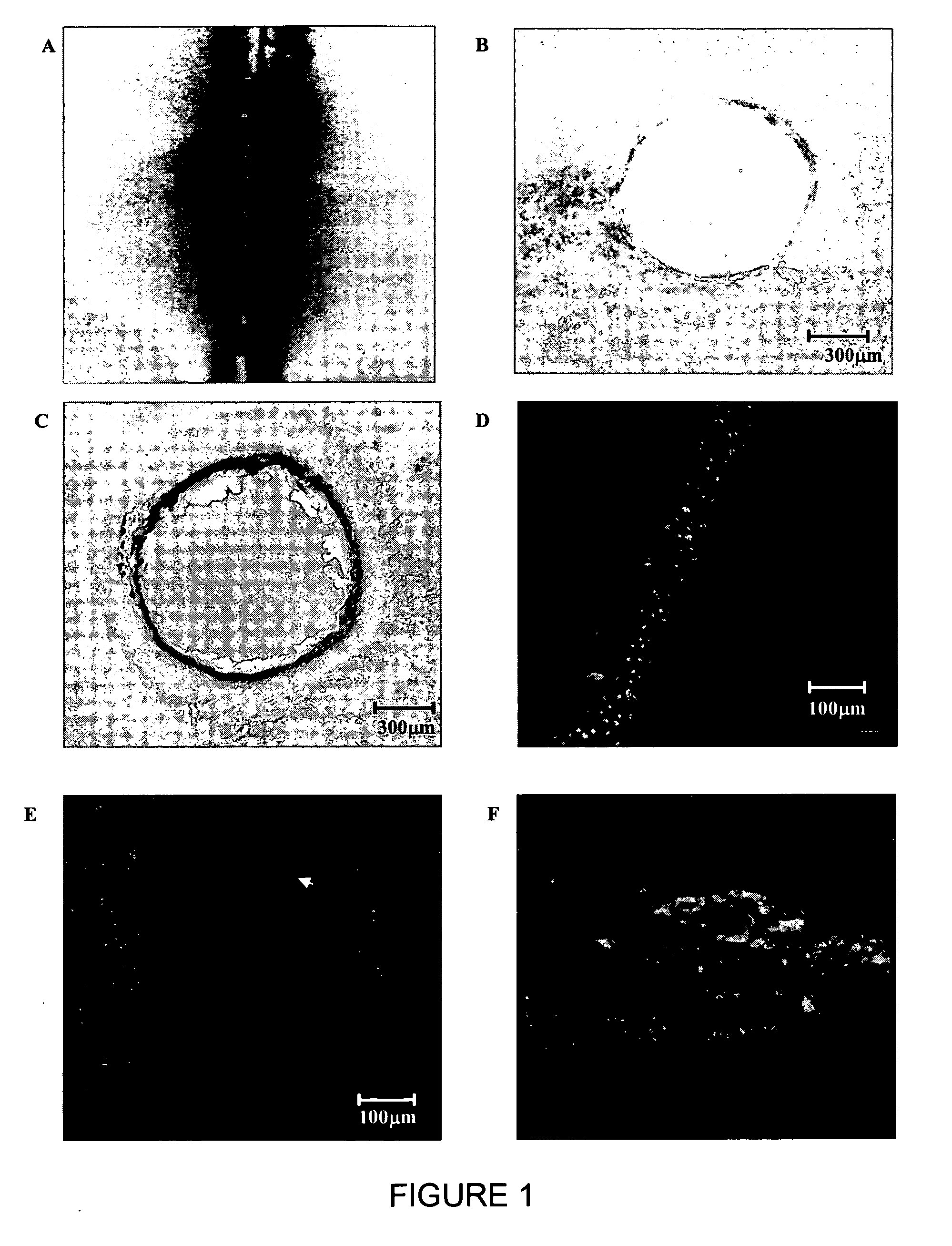 Laser selective cutting by impulsive heat deposition in the IR wavelength range for direct-drive ablation