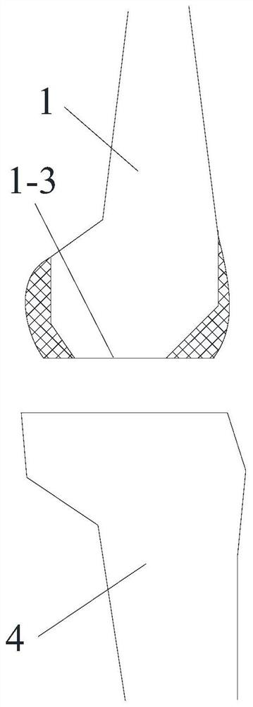 Knee joint bone surface replacement device