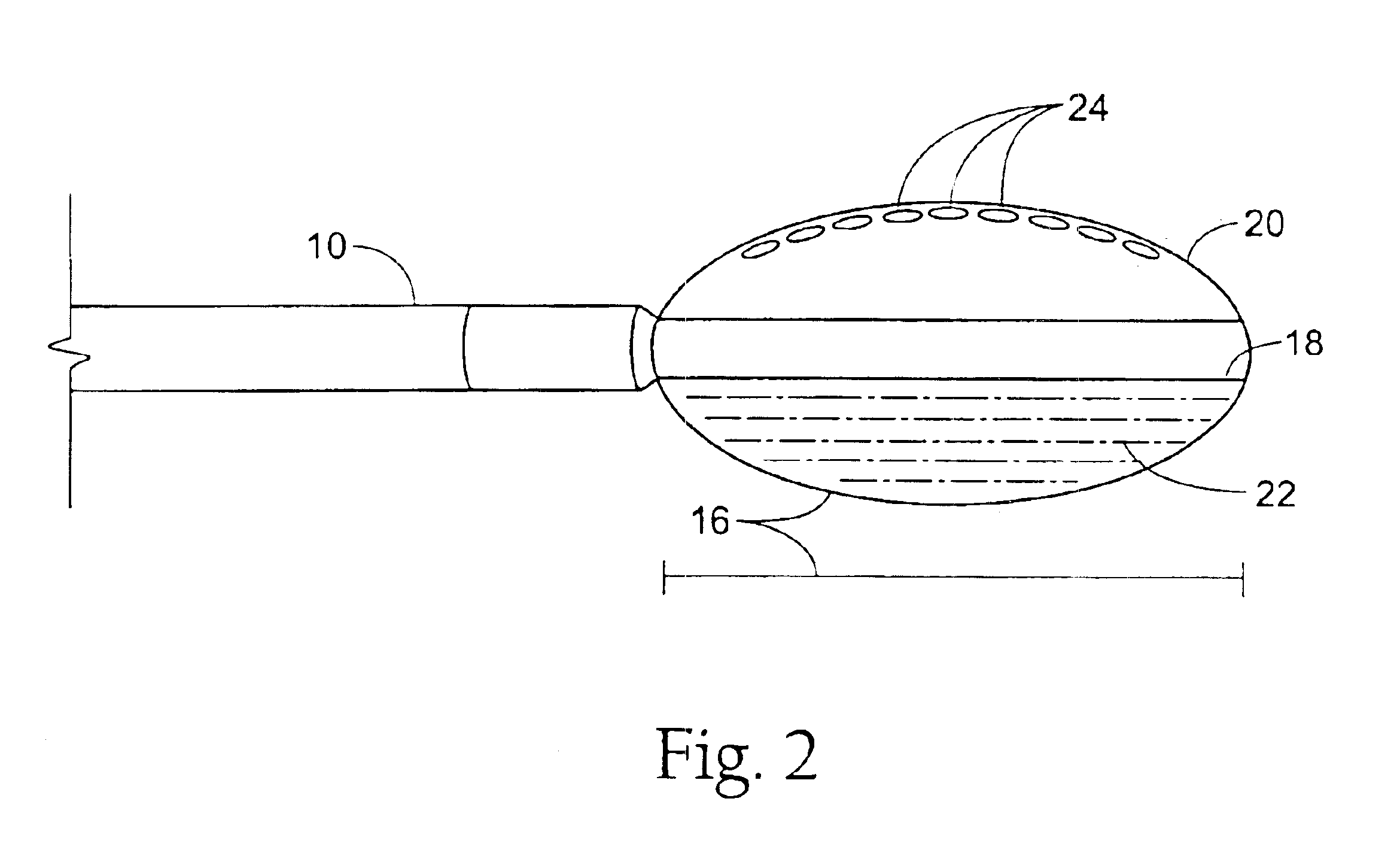 GERD treatment apparatus and method