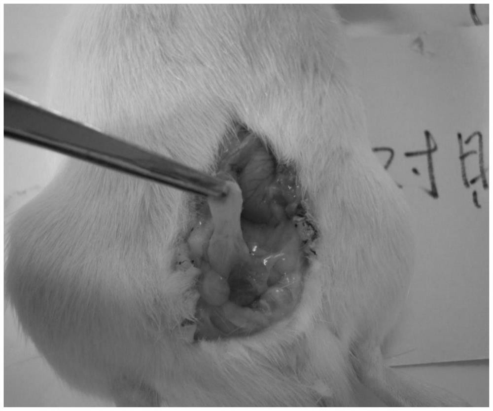 Composition containing flos sophorae immaturus/kernel of fructus actinidiae chinensis for treating prostatic diseases and preparation of composition