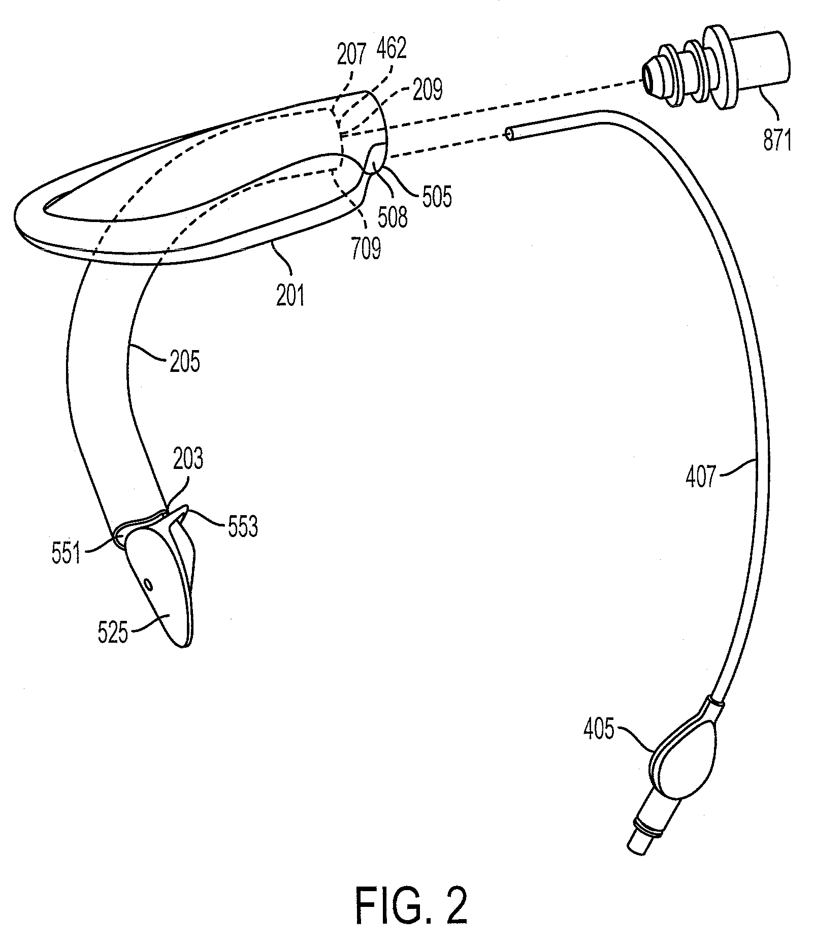 Laryngeal Mask