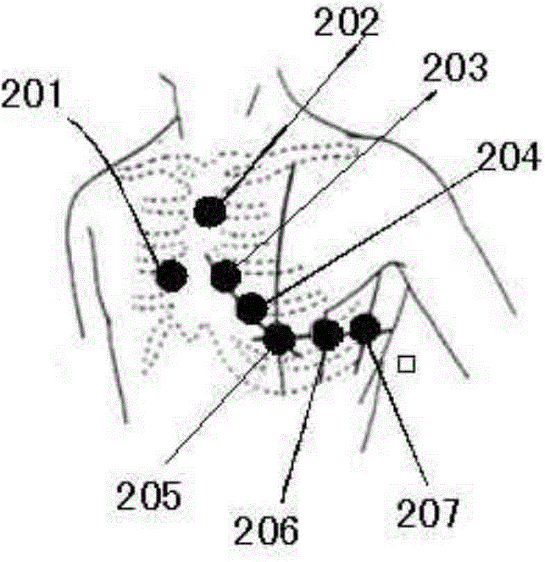 A comprehensive heart detection device based on heart sound and electrocardiogram