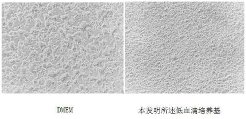 Low serum medium applicable to culturing of LMHs cell adhering to walls and preparation method of low serum medium