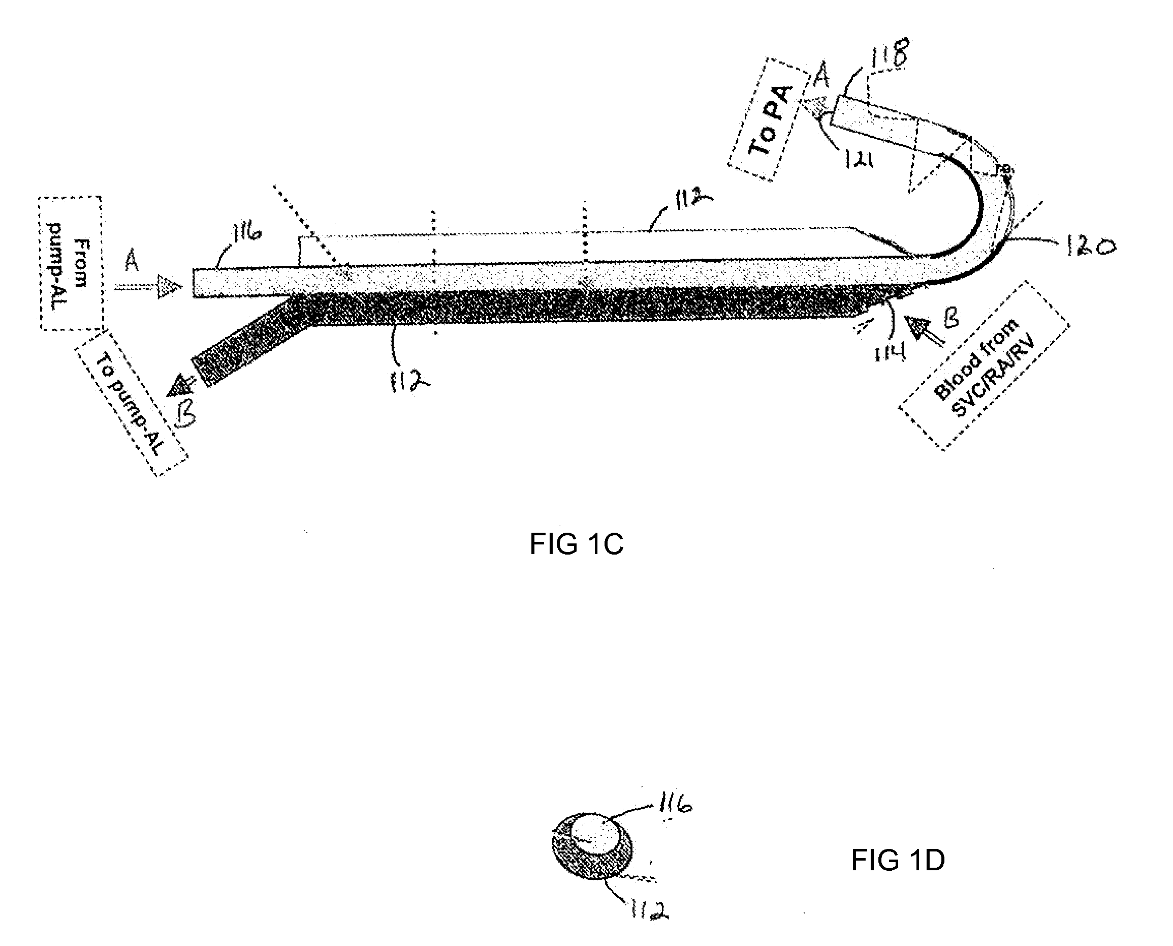 Dual lumen cannula for artificial lung and right ventricular assist device