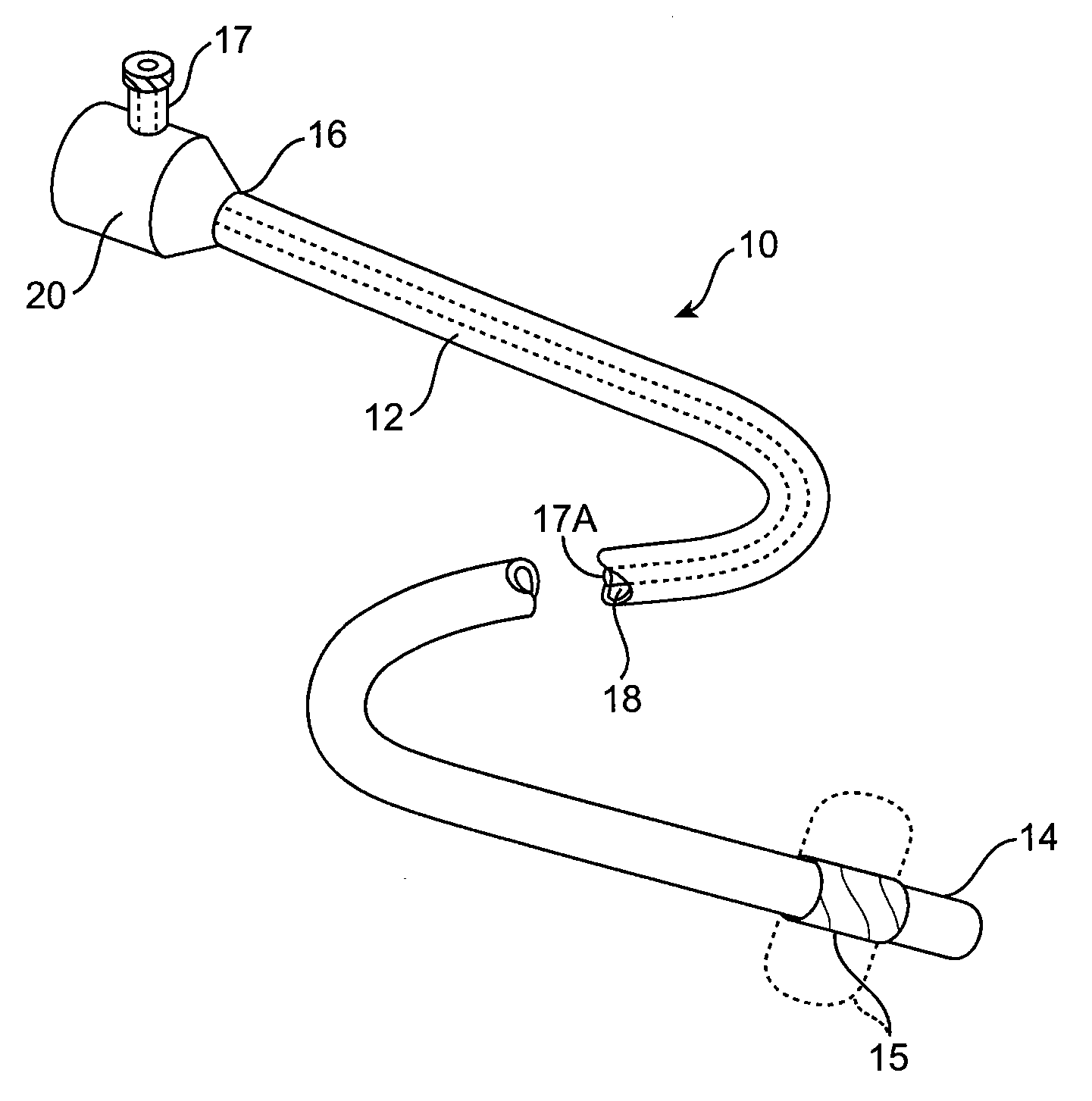 Methods and devices for passive residual lung volume reduction and functional lung volume expansion