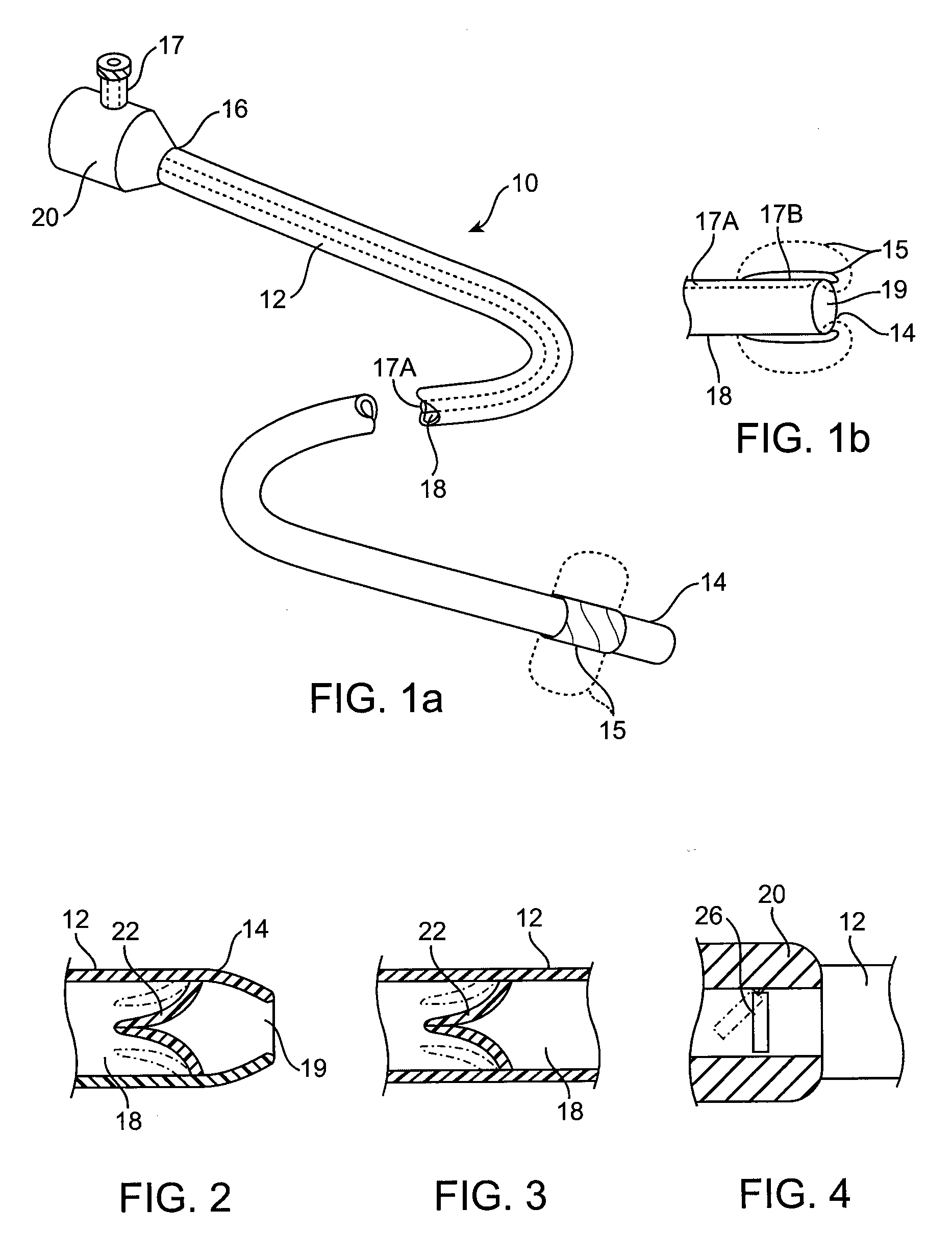 Methods and devices for passive residual lung volume reduction and functional lung volume expansion