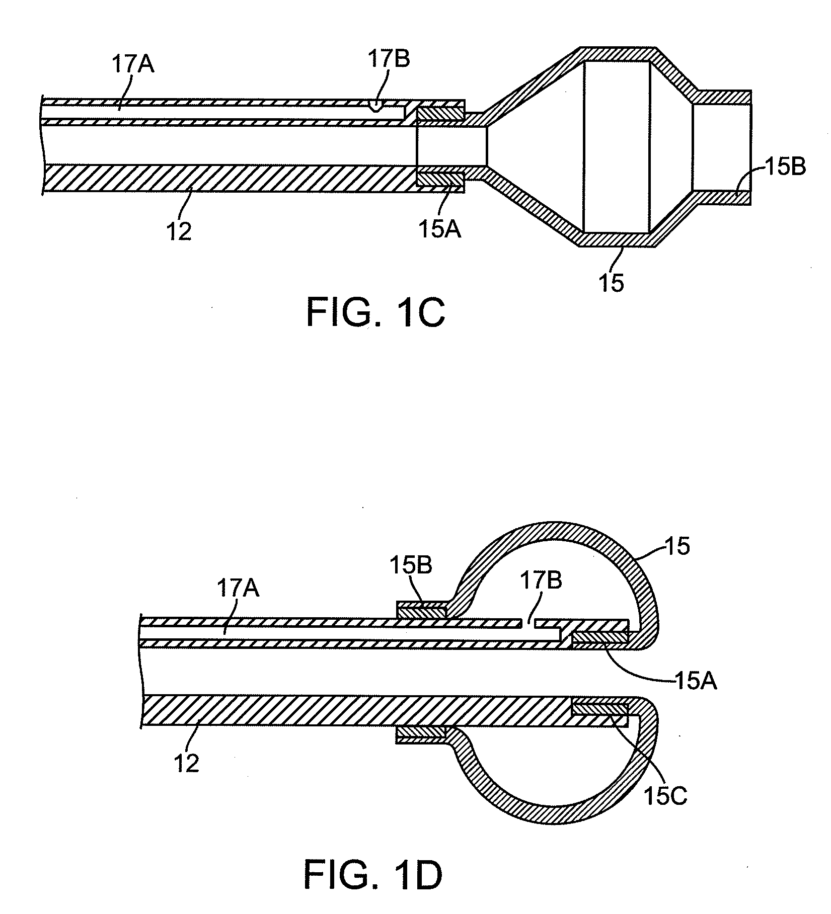 Methods and devices for passive residual lung volume reduction and functional lung volume expansion