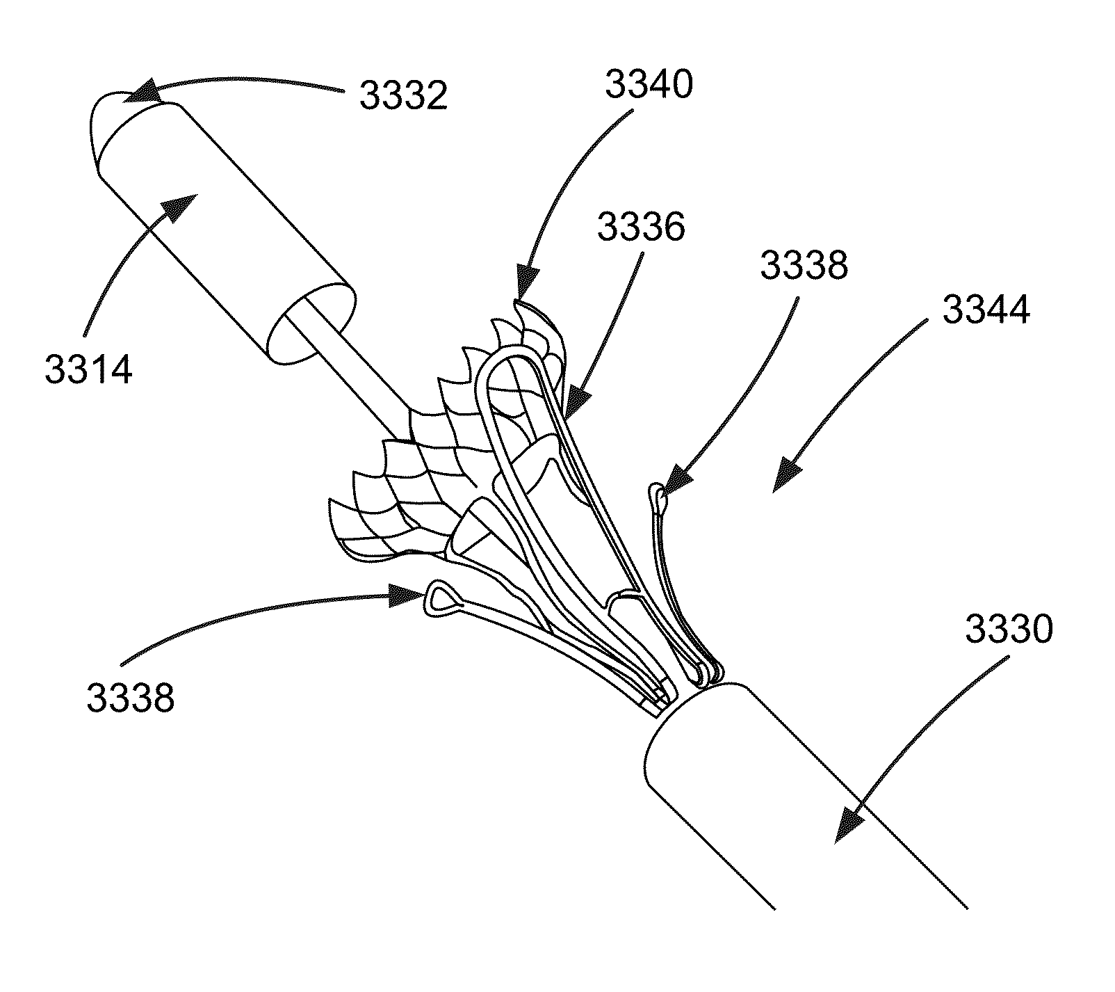 Heart valve assistive prosthesis