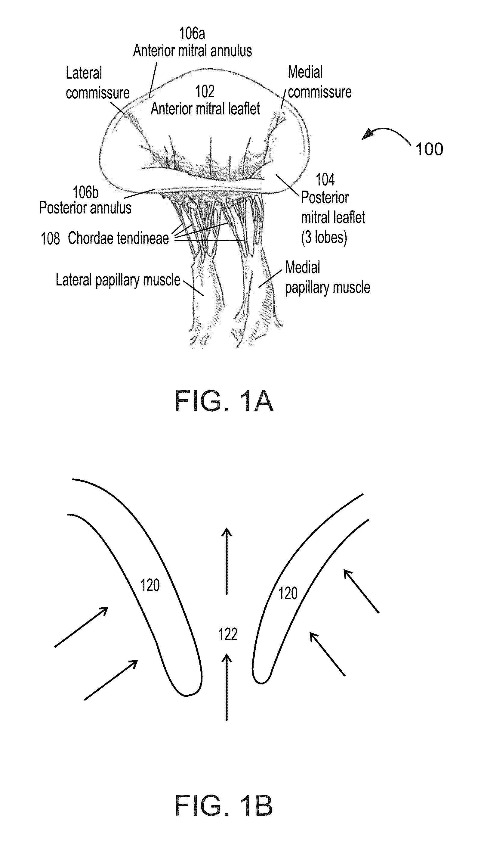 Heart valve assistive prosthesis