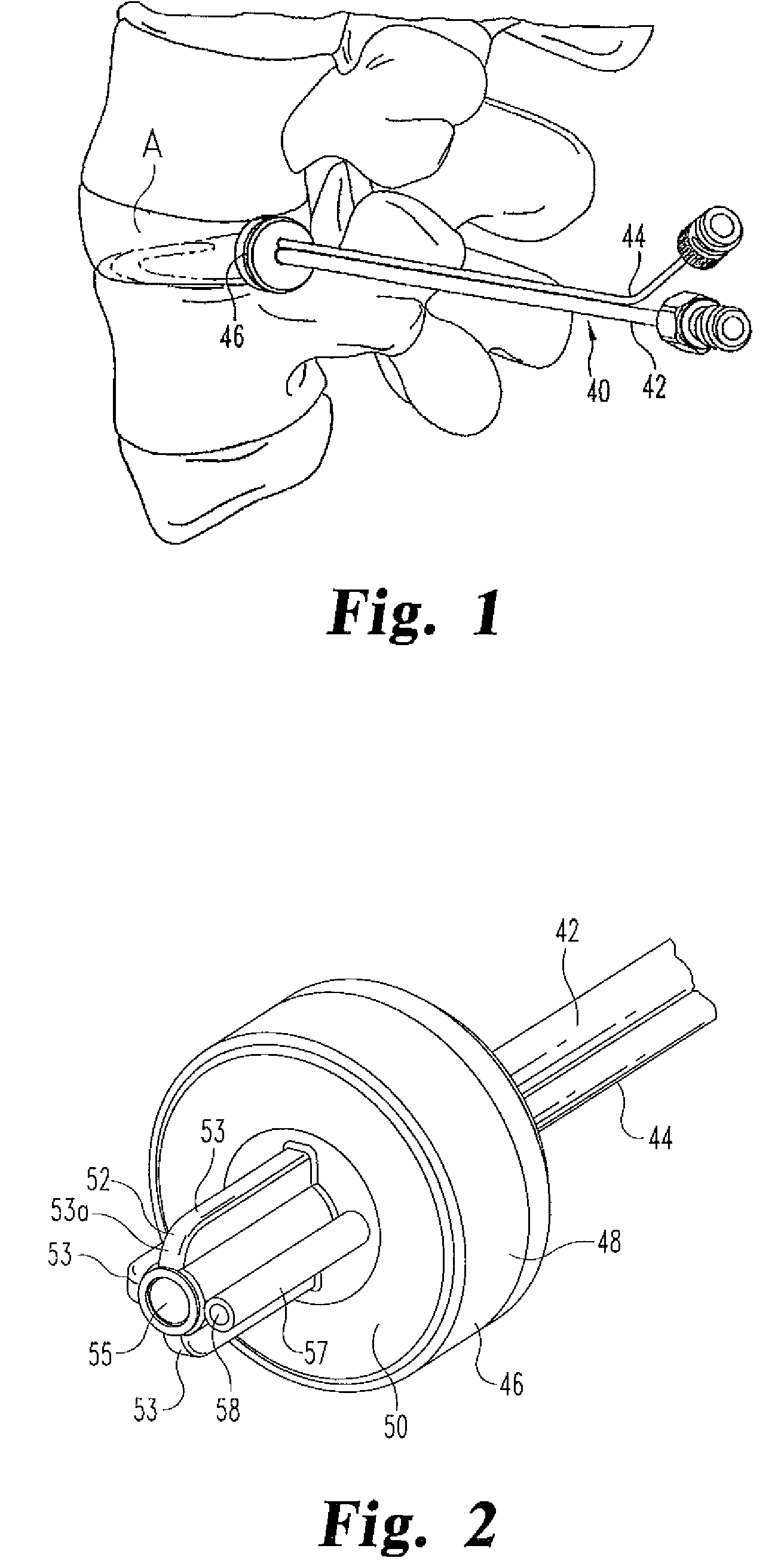 Articulating injection cannula and seal assembly