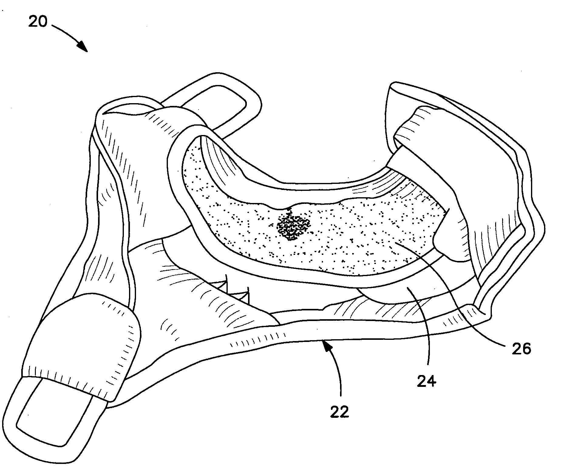 Sanitary garment and method for making same