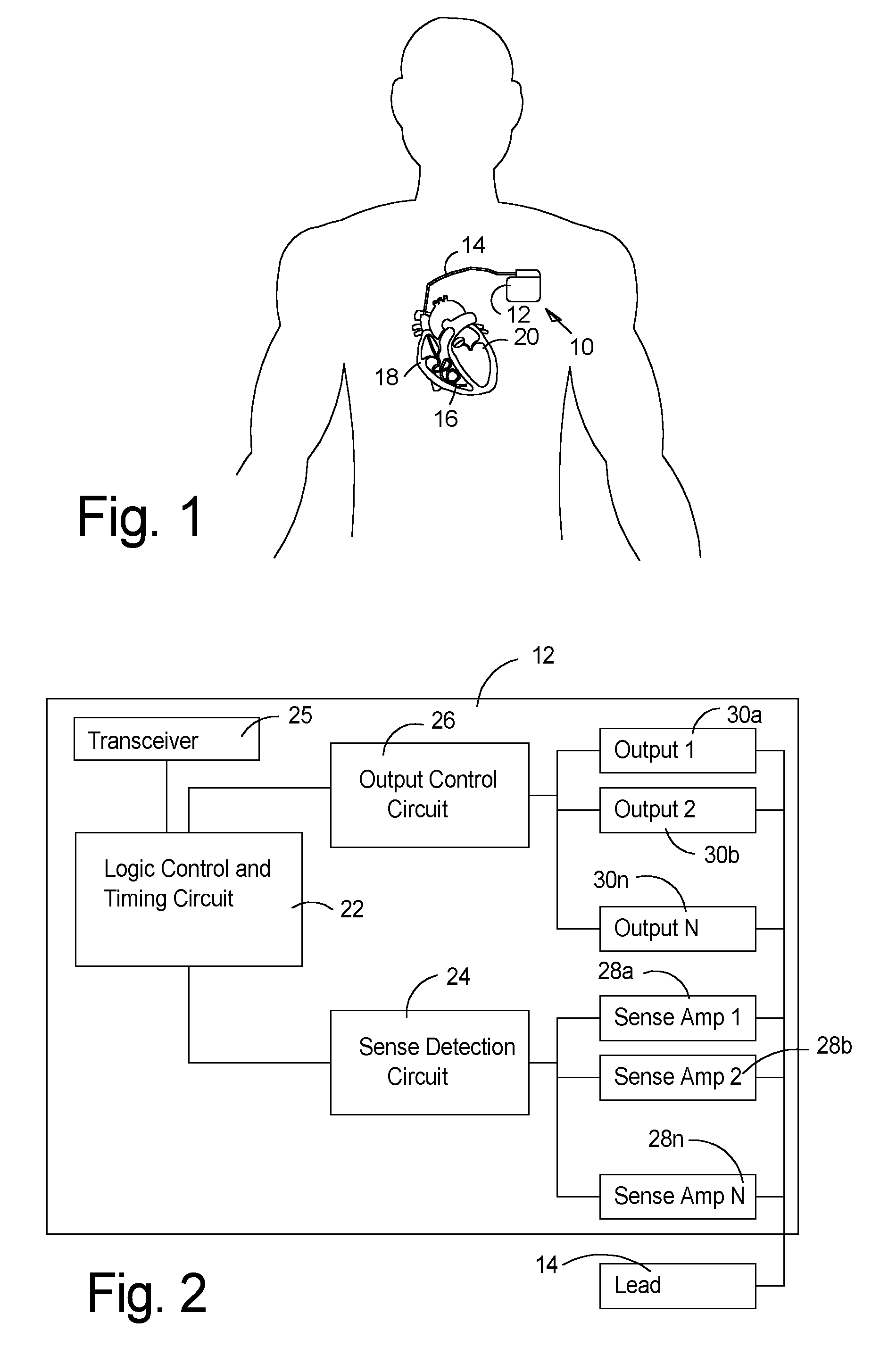 Cardiac Stimulation Apparatus With Multiple Input Sense Amplifiers