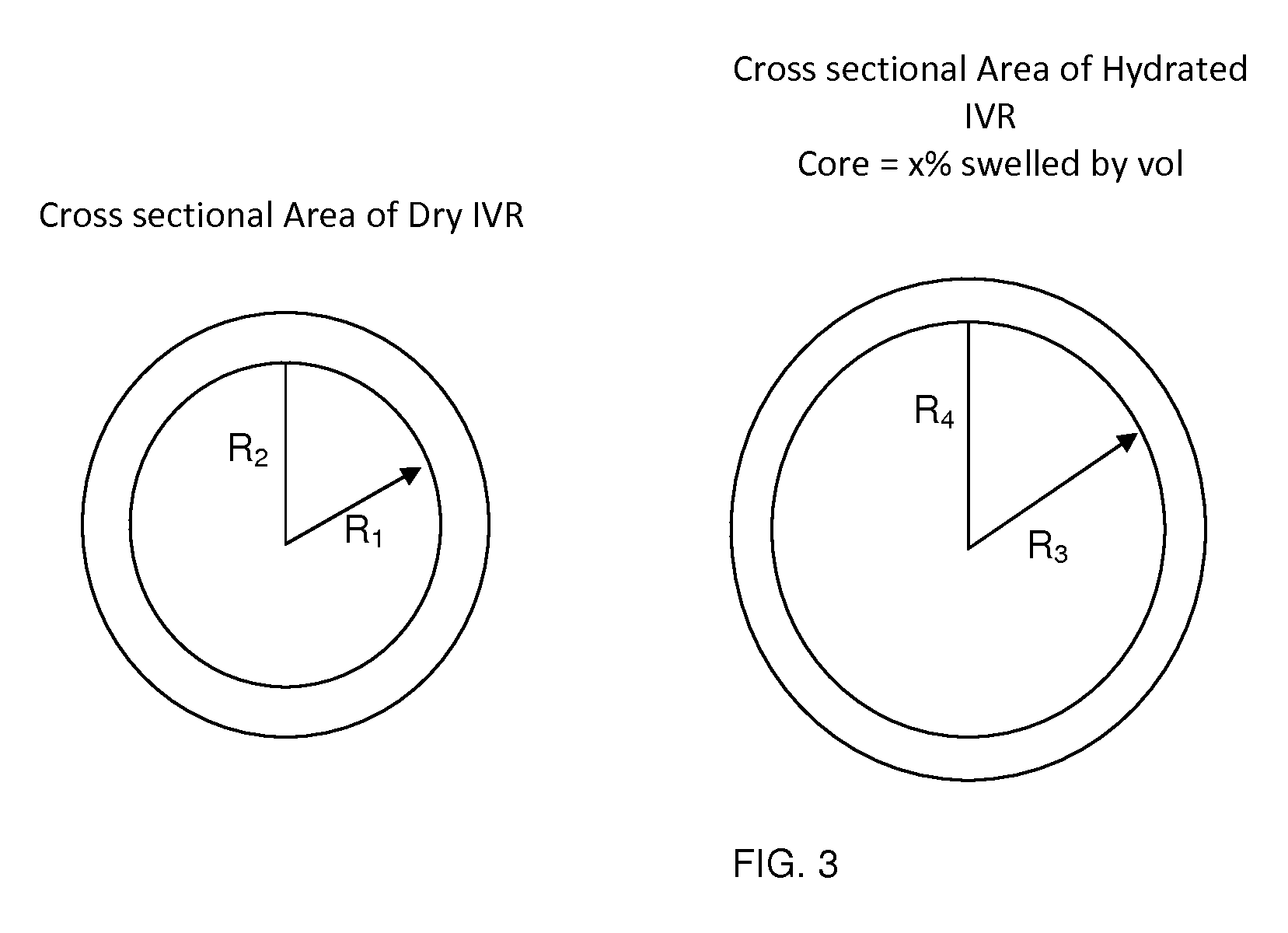 Core sheath drug delivery devices