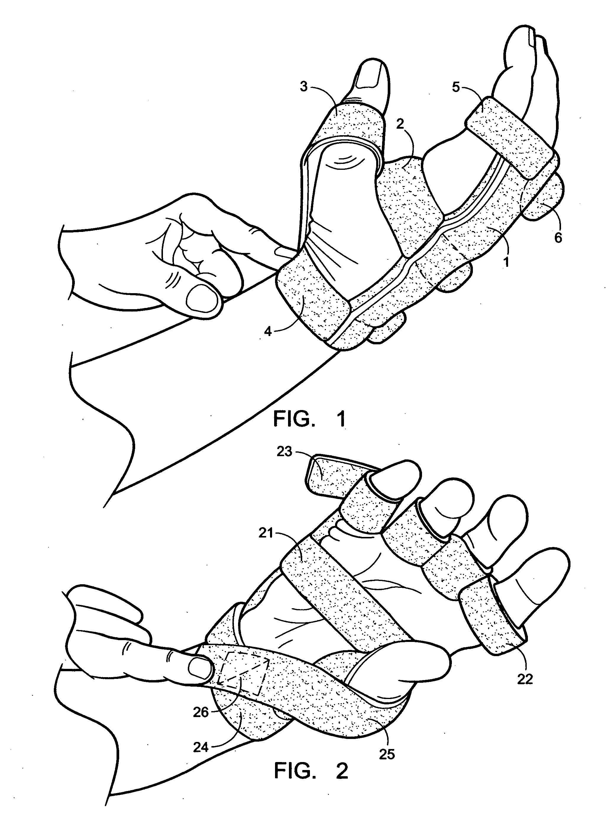 Low-profile, radial nerve splint with interchangeable resilient digit extensor elements