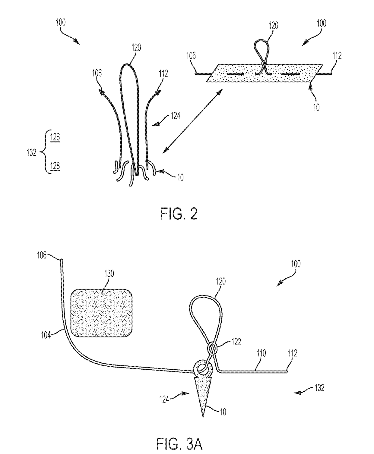 Anchored Loop-in-Loop Suture Anchor