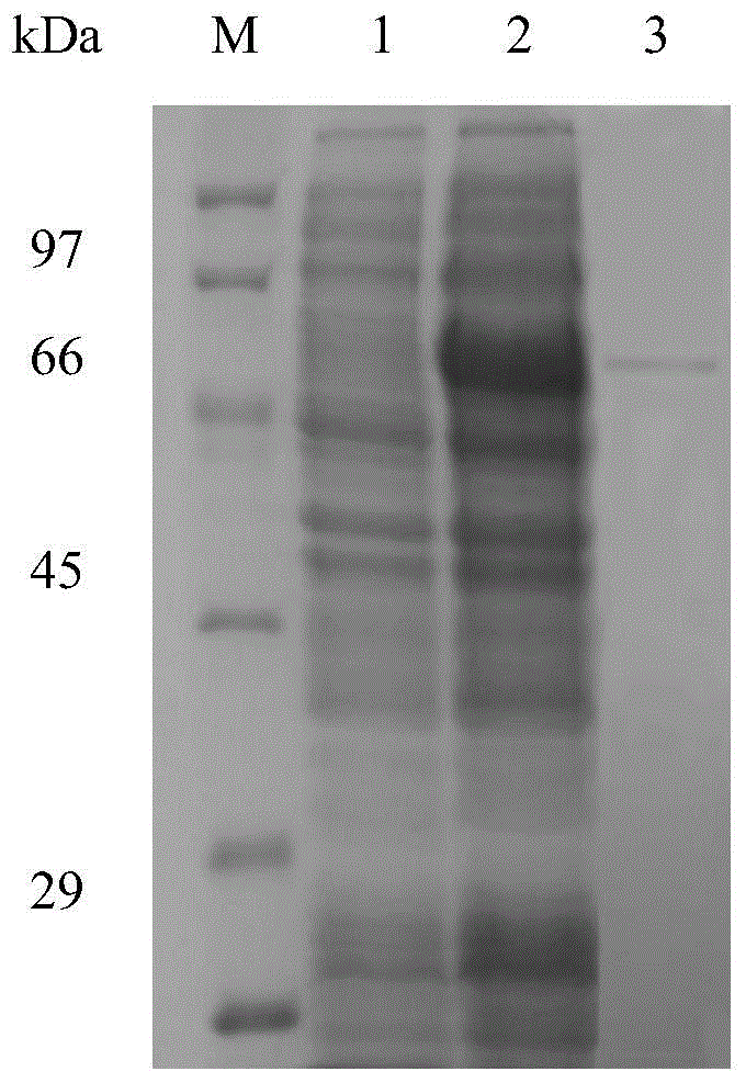 Arylsulfatase and preparation method and applications thereof