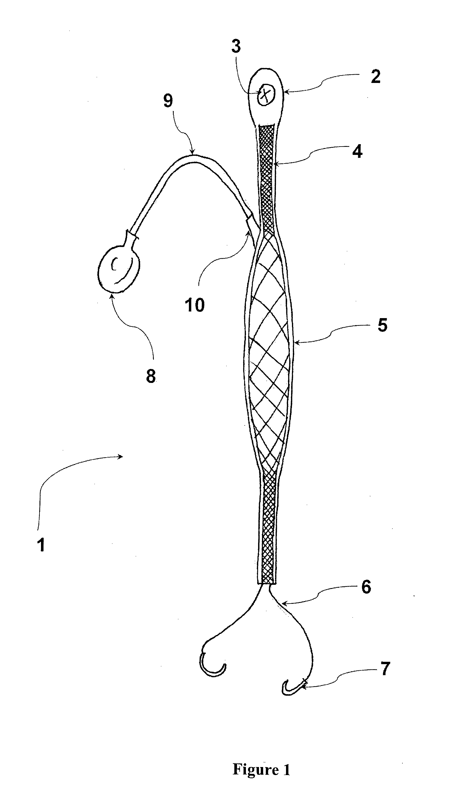 Adjustable elastic antagonist muscle replacement mechanism