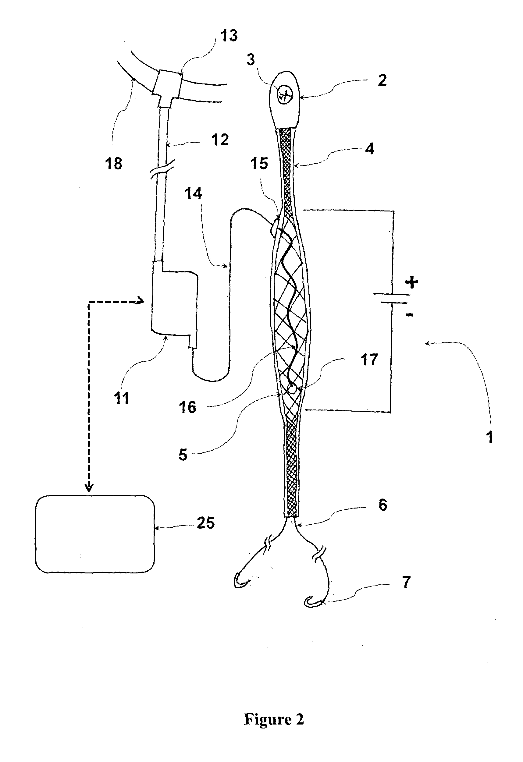 Adjustable elastic antagonist muscle replacement mechanism