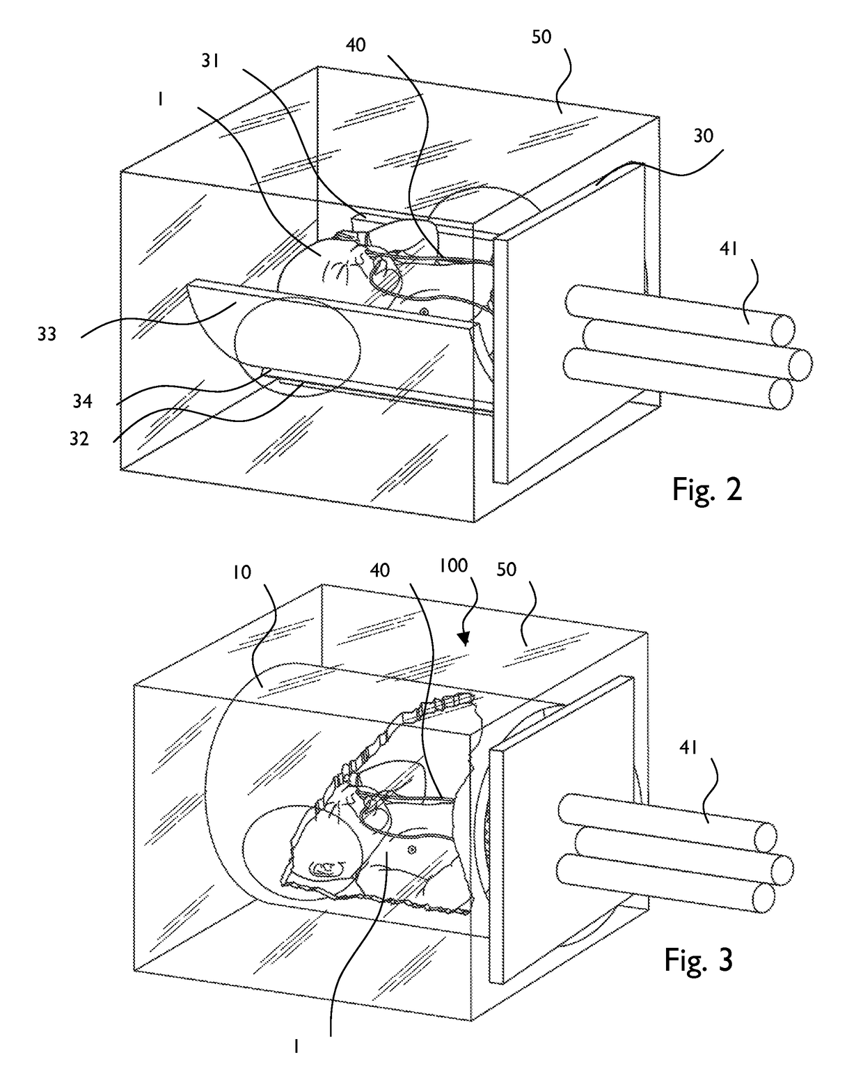 Premature neonate closed life support system