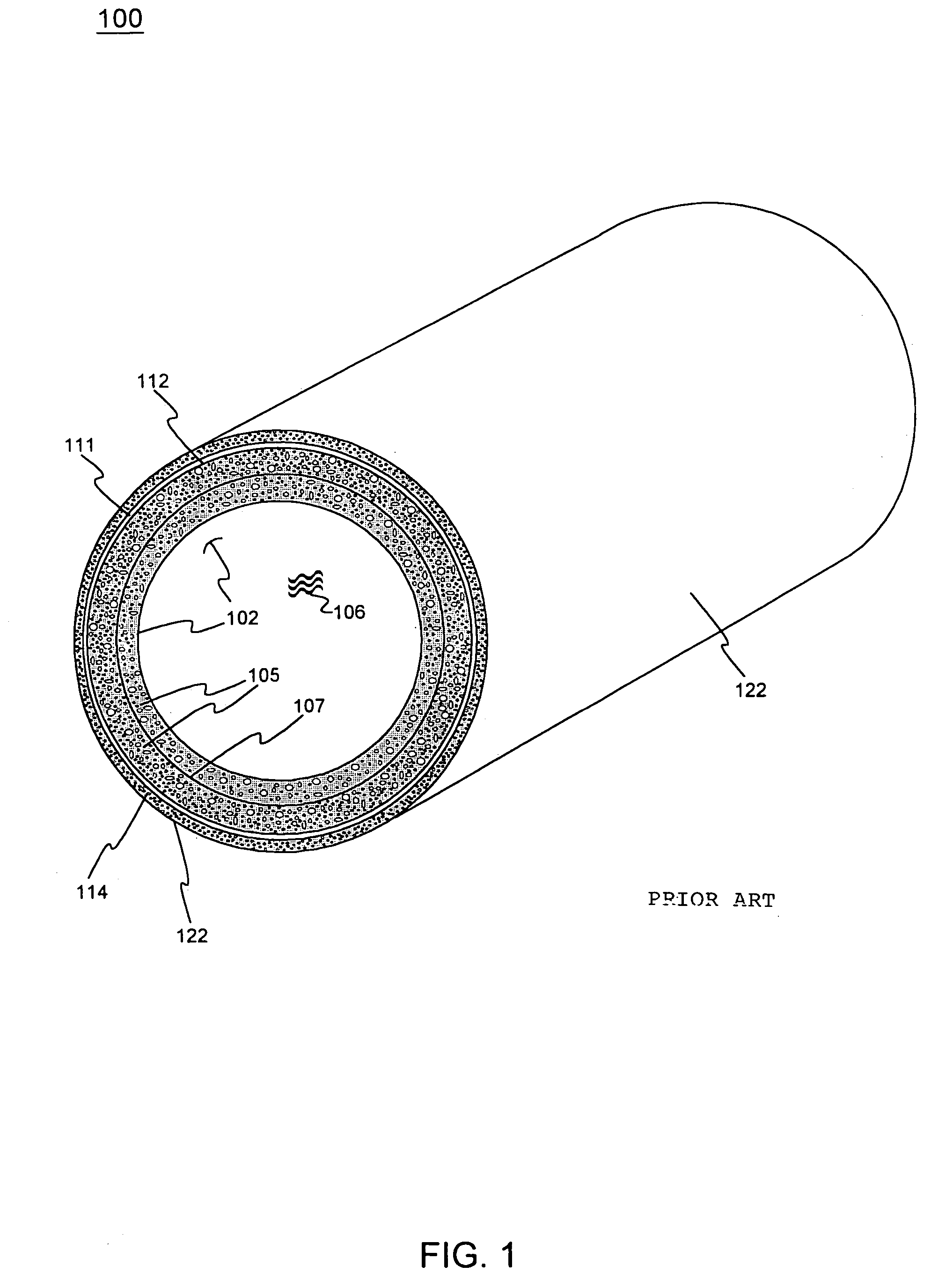 System and method for pipeline reliability management